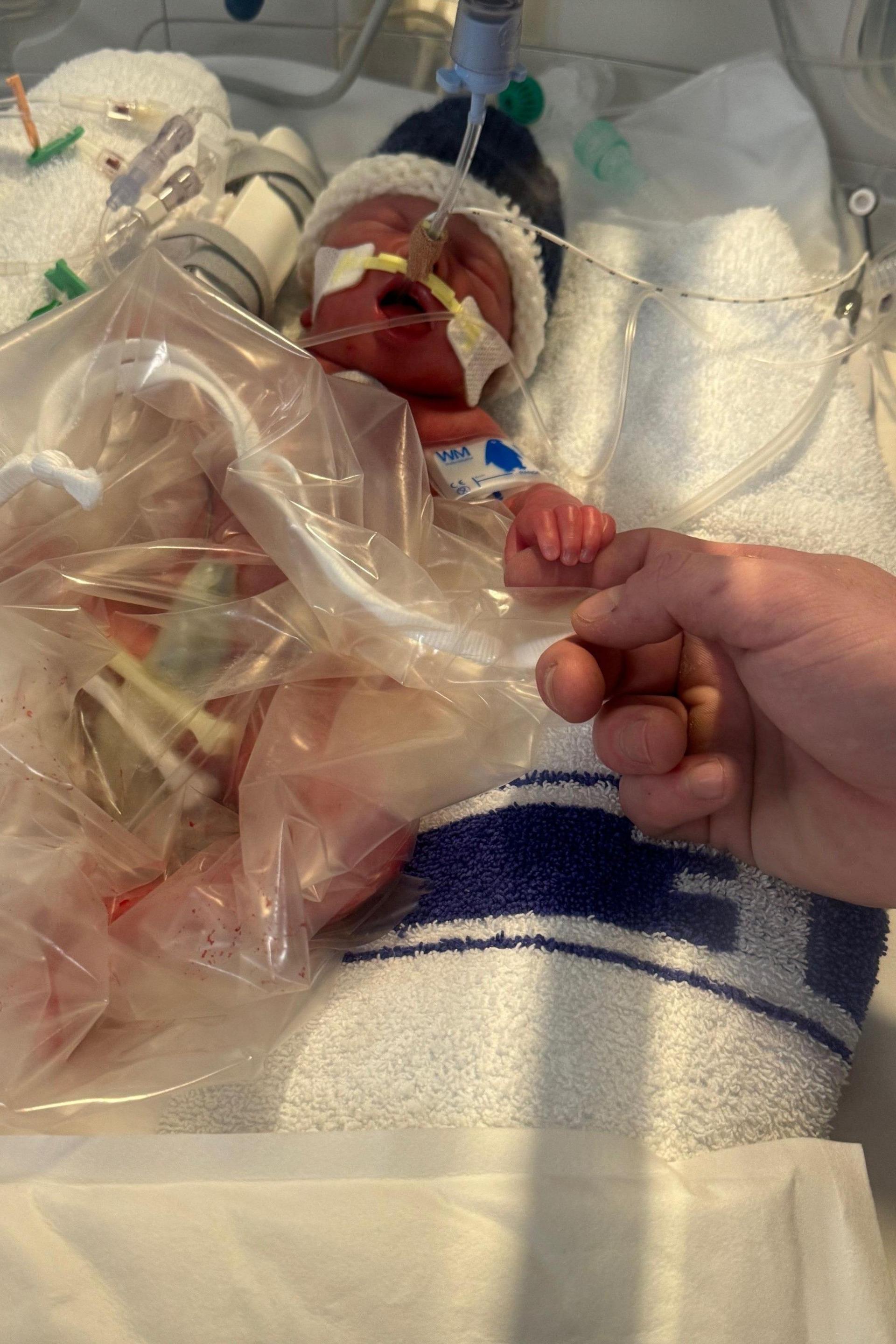 A newborn baby still in hospital, clutching its parents' finger.