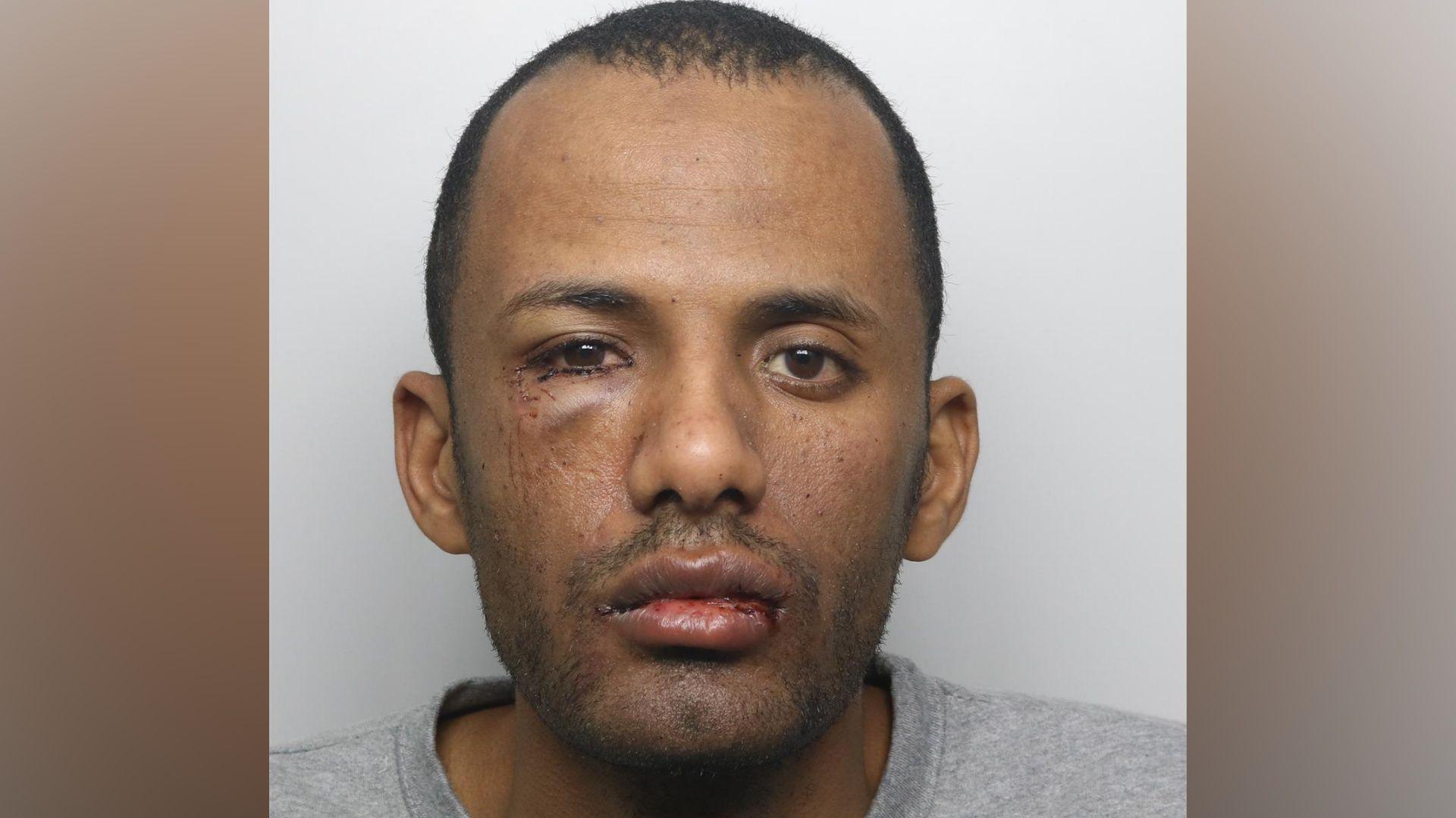 A mugshot of Ibrahim Albashir. He has short, dark hair and brown eyes. He has a cut to his lip and a bruise beneath his right eye. He is wearing a grey jumper.