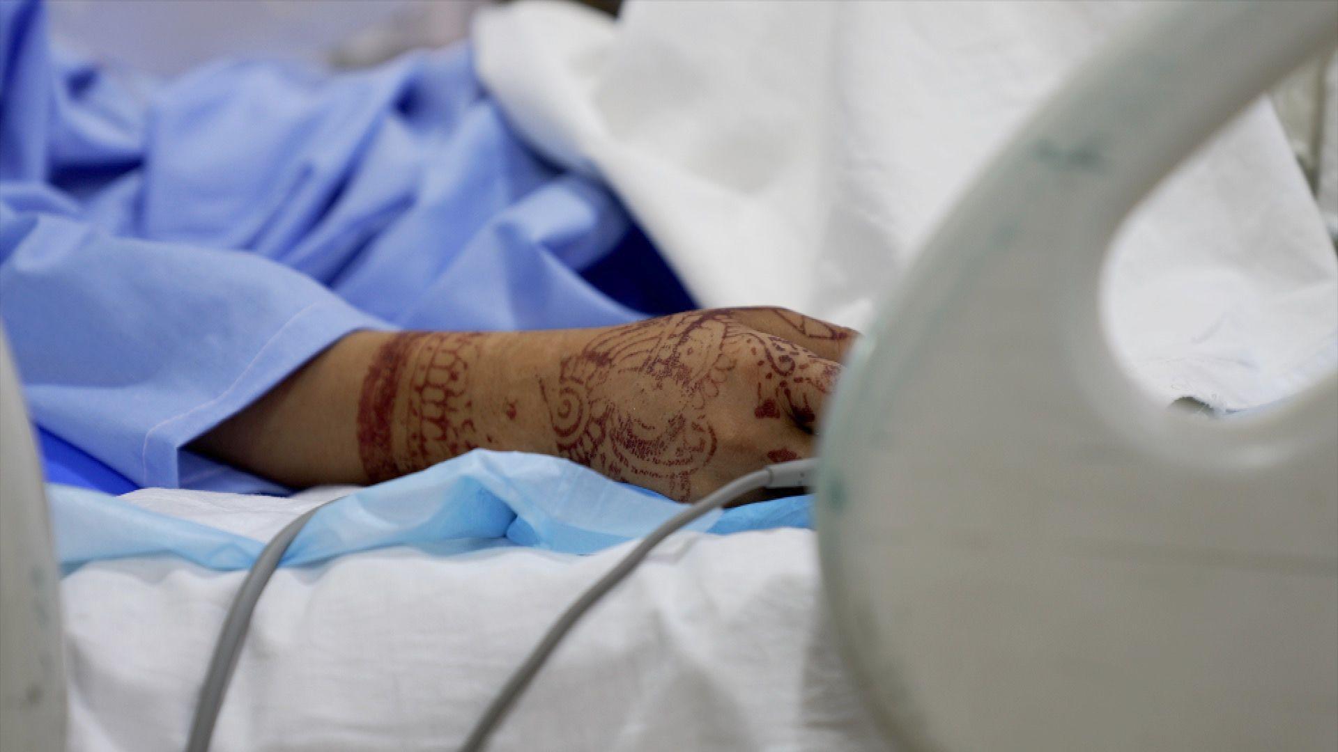 The arm covered with henna, of a student being treated in the Combined Military Hospital, in Quetta