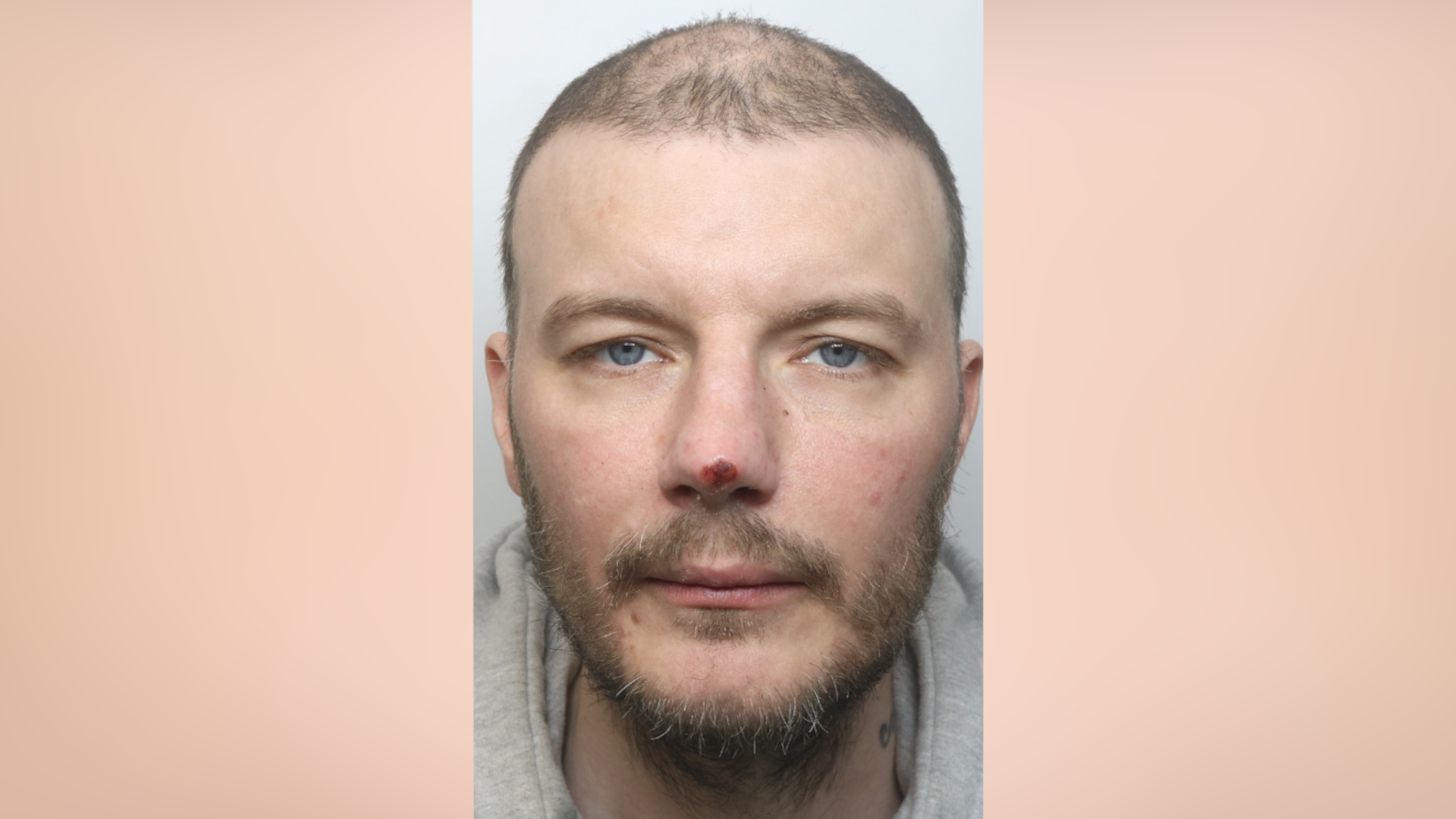 A headshot of a man wearing a grey hoodie. He has thinning hair, blue eyes, facial hair and a cut on his nose.