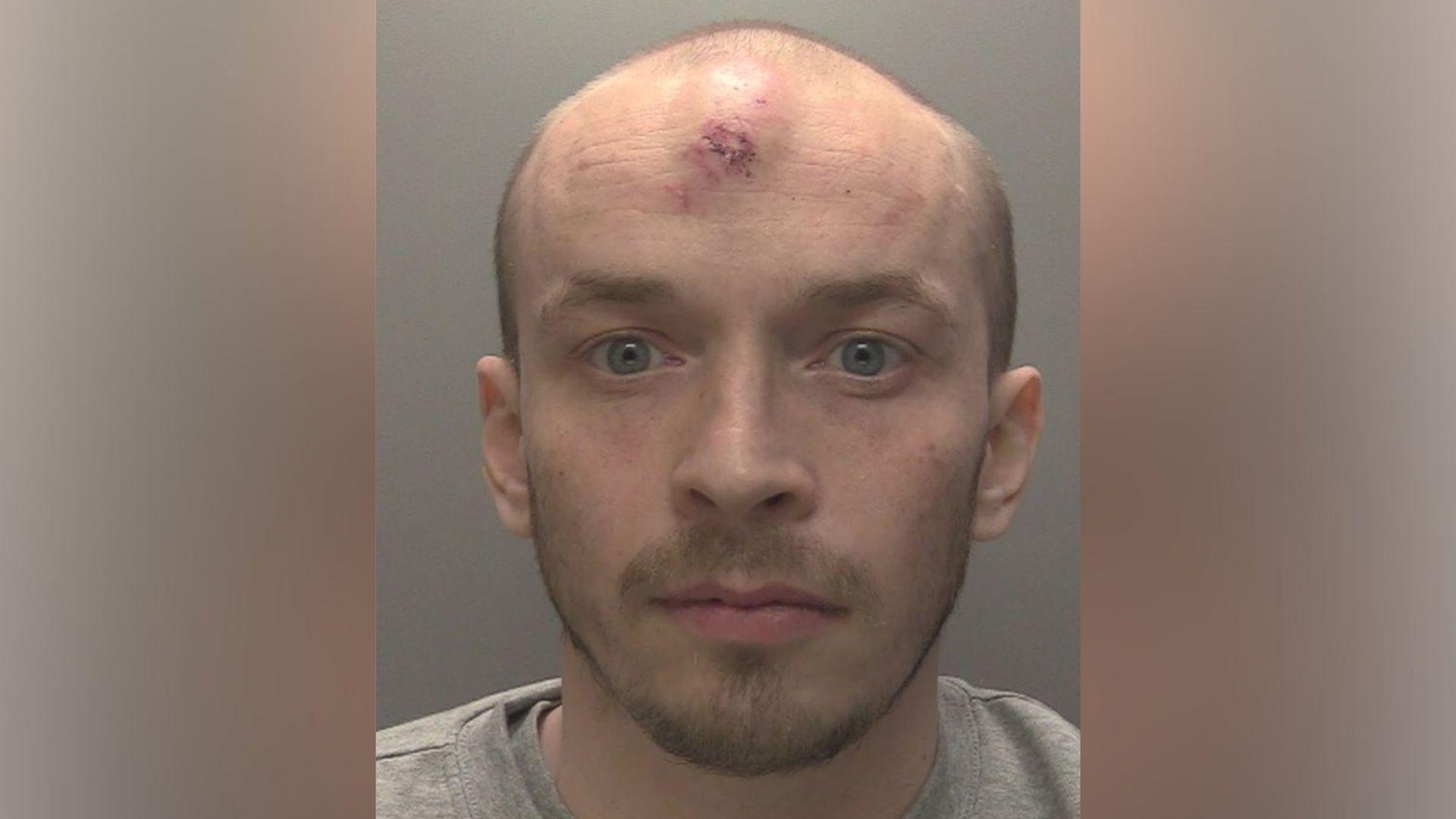 A police handout photo of Declan Wild in custody. He has balding hair, wears a grey t-shirt, and has a large abrasion on his forehead.