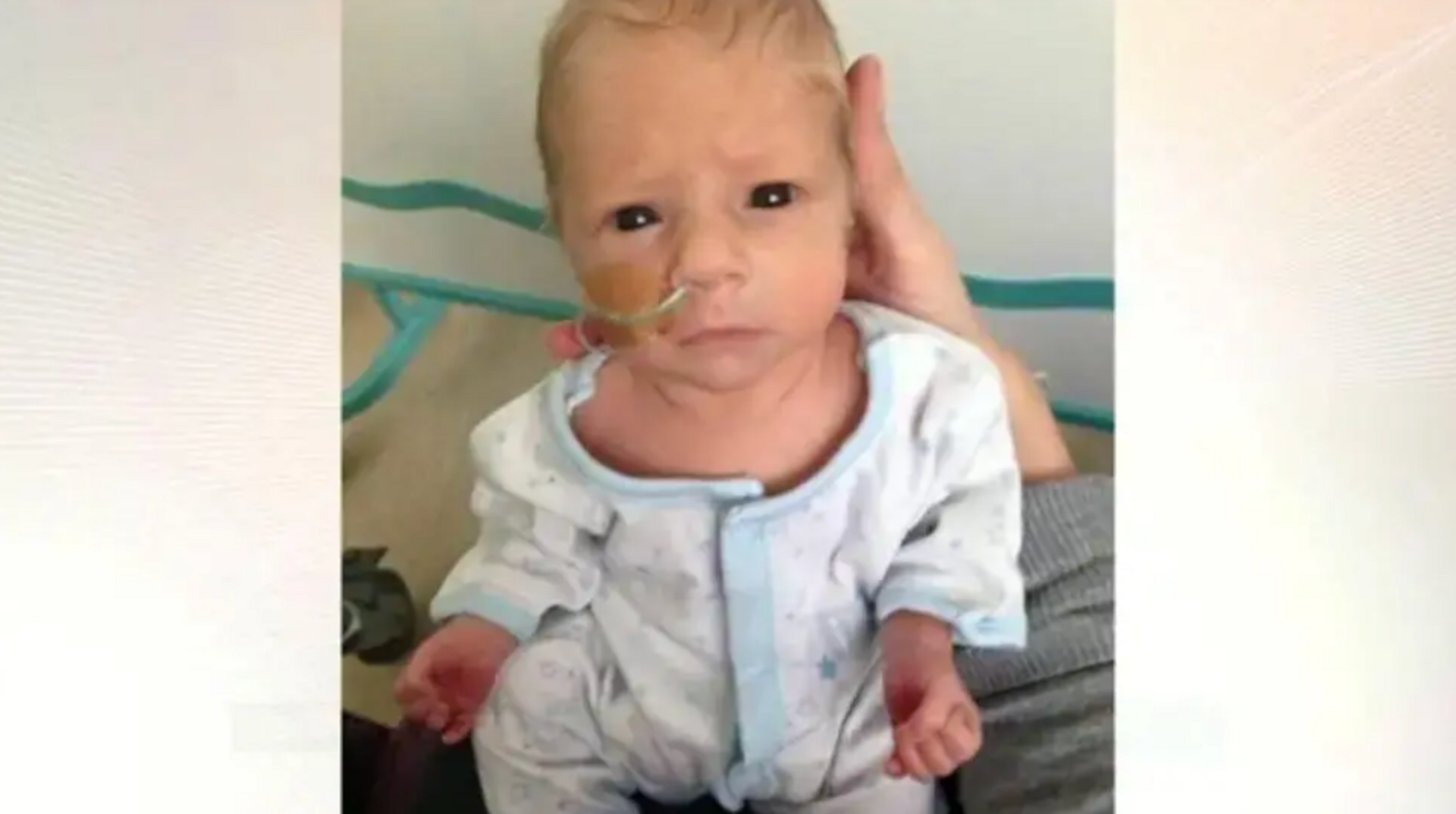 A small baby in a white and light blue babygrow is being held upright. His head is small enough to fit into the hand of the person holding him. A feeding tube is coming out of his nose.