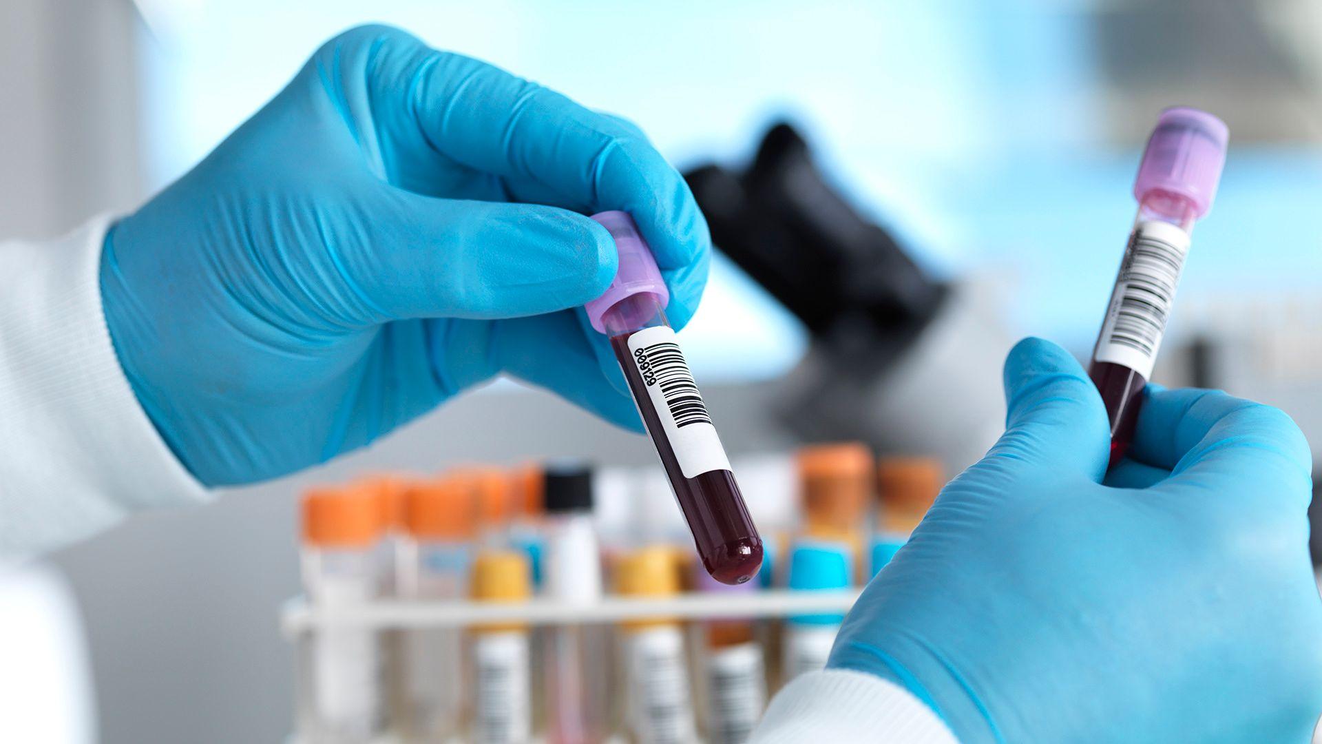 Stock photo shows a lab setting with close up of gloved hands holding tubes of blood with bar codes on them, with other tubes in background with bokeh.