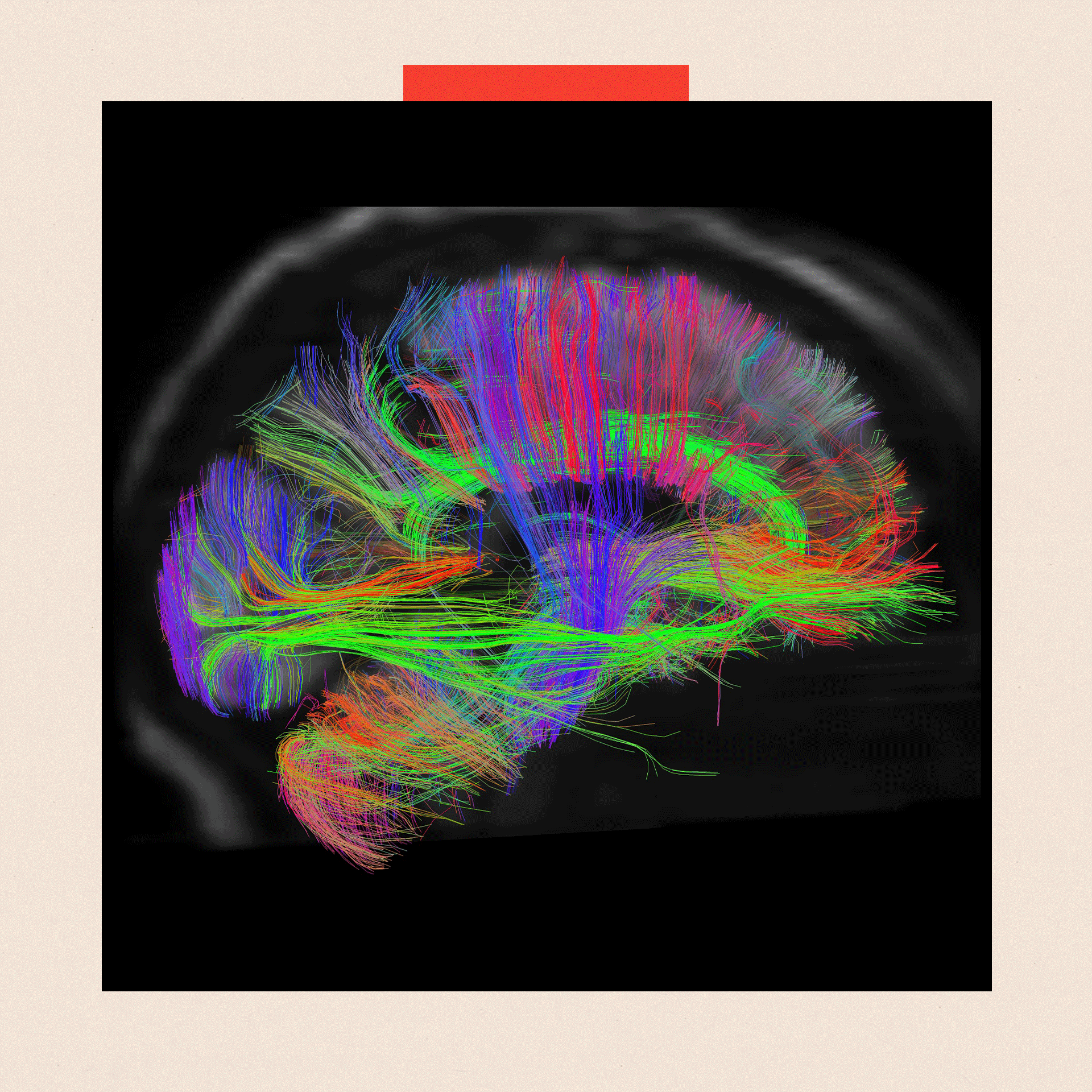 A brain scan