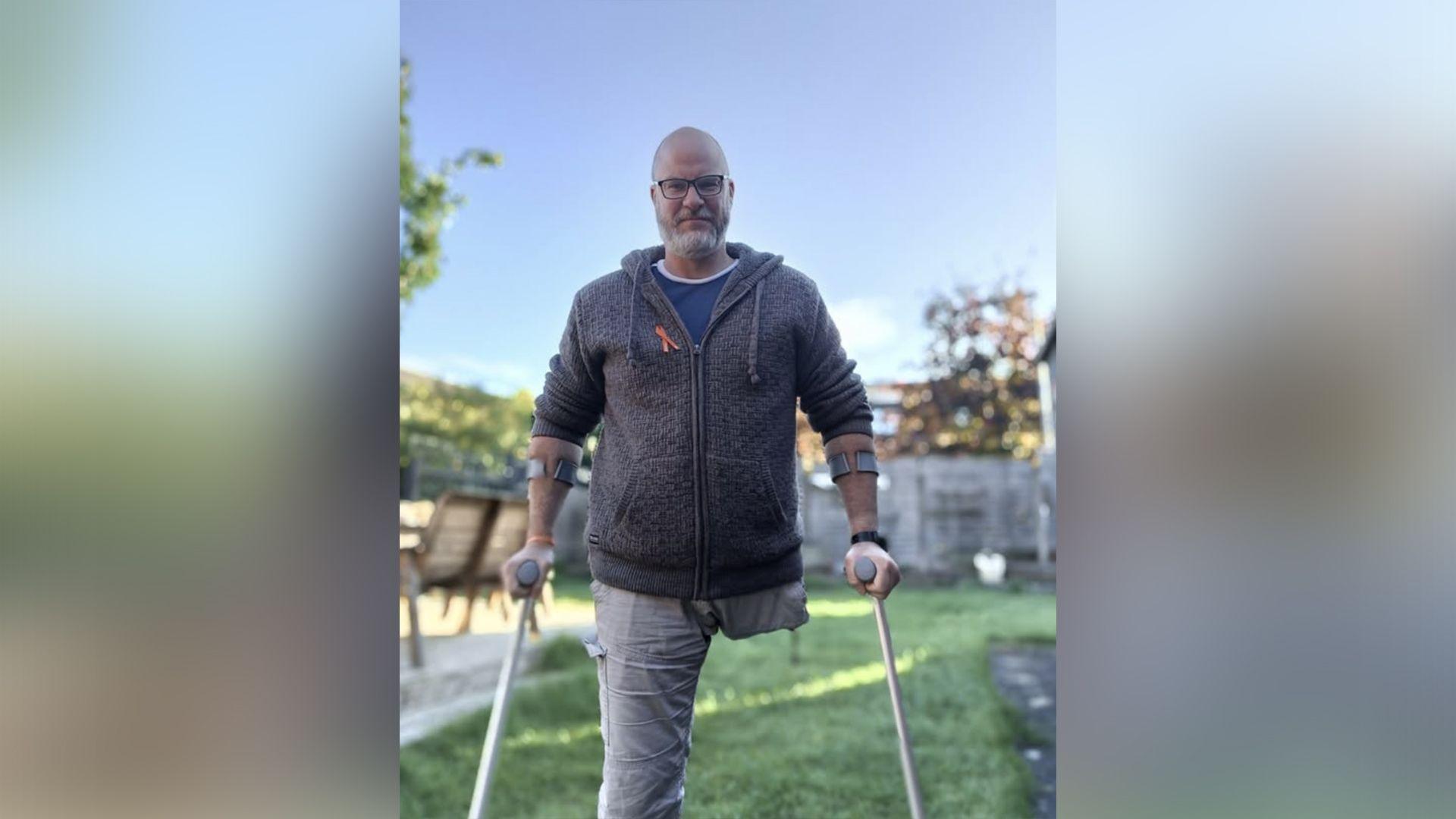 Picture of Pete Lloyd in garden. He has one leg (left leg) and is on crutches. He has a dark blue jumper on and light jeans.