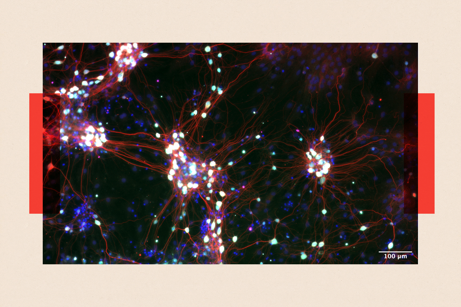 Close-up of nerve cells 