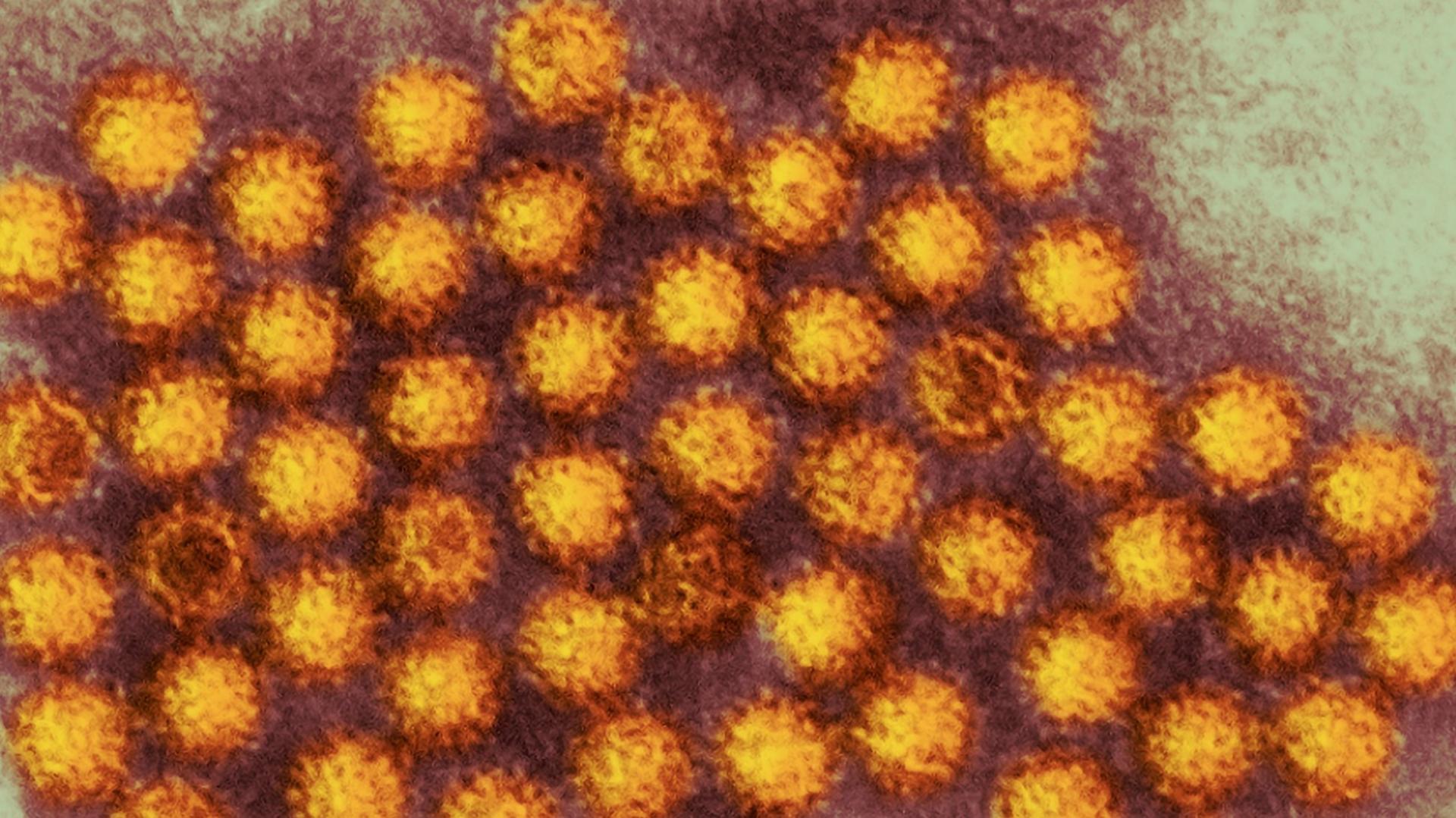 Norovirus image