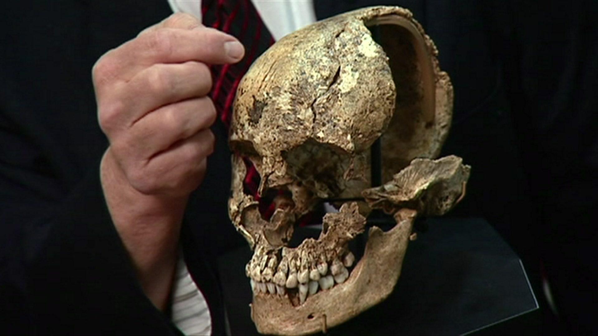 Man points to skull