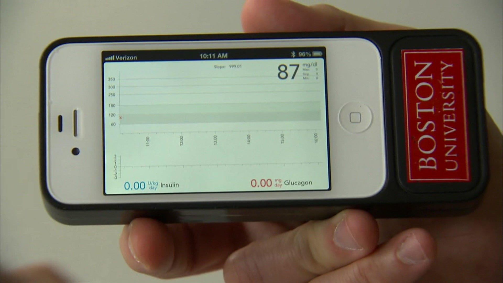 A smartphone with a Boston University logo is held in one hand. On screen can see the algorithm app used for the bionic pancreas device.