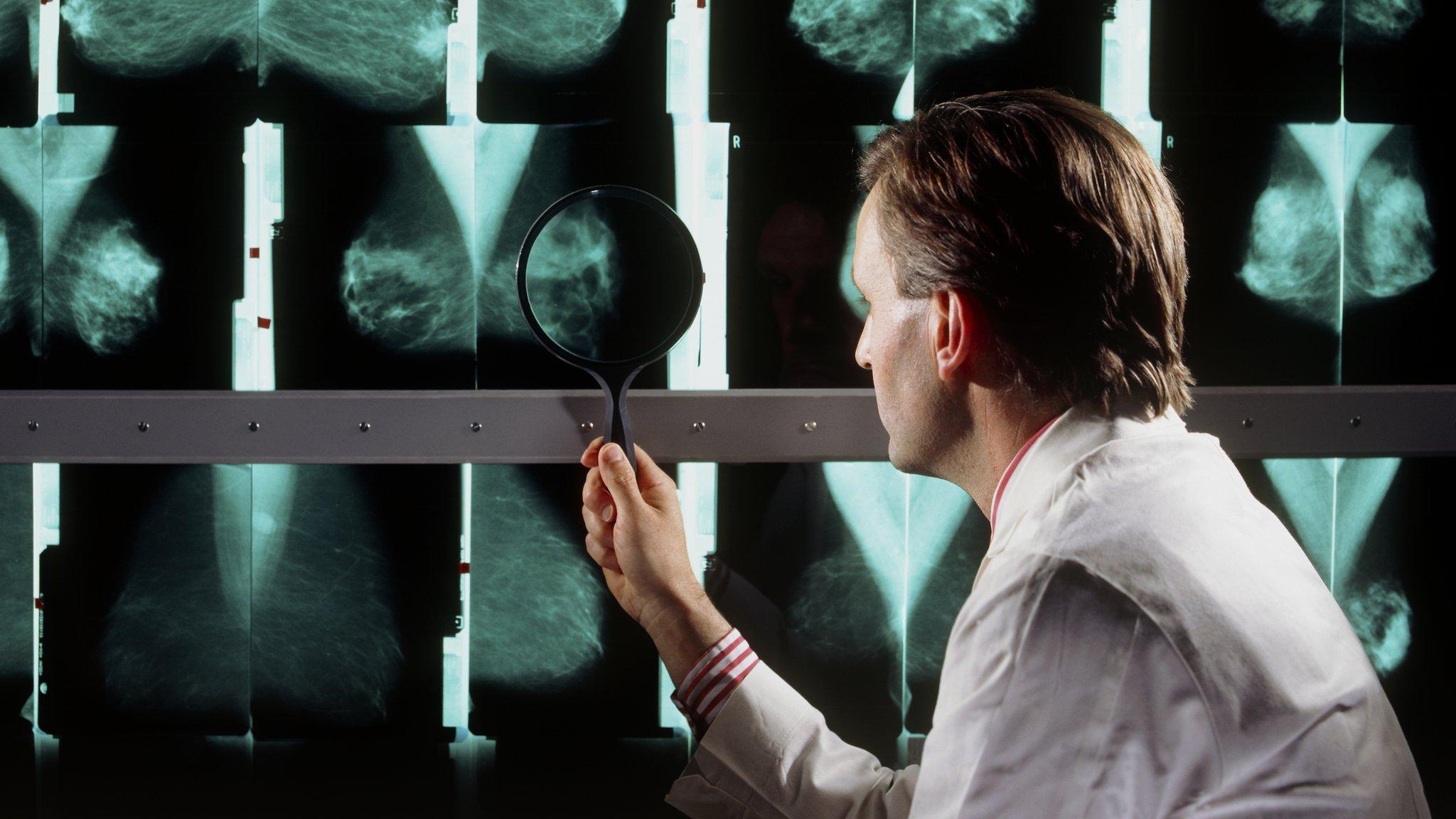 Doctor analysing mamograms