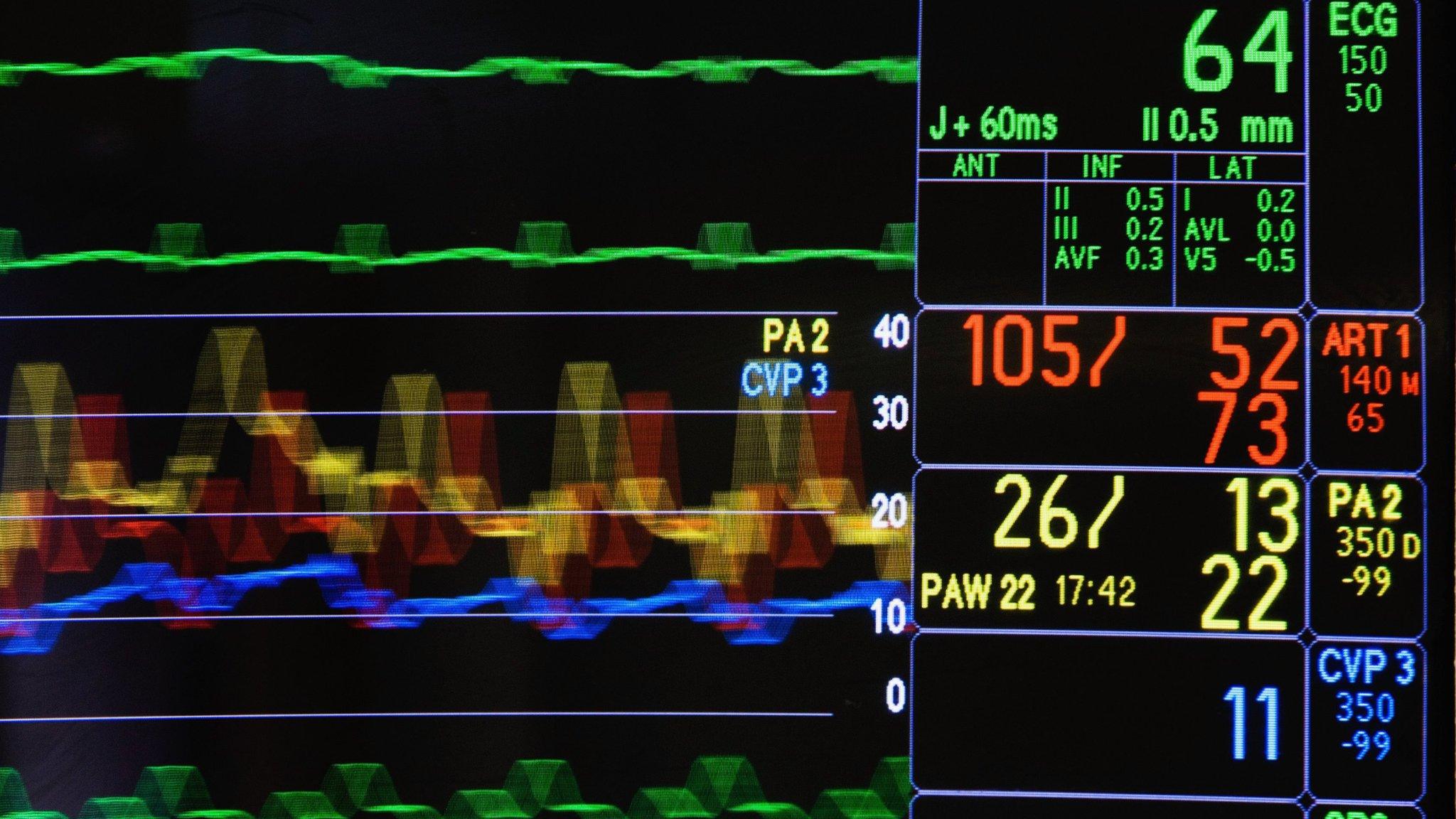 Intensive care monitor