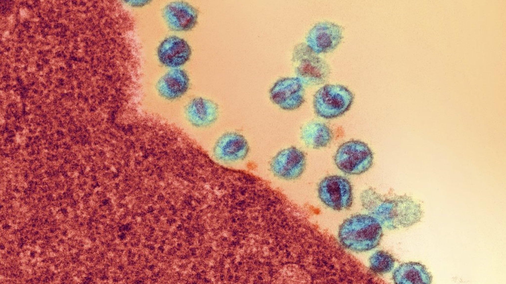 HIV