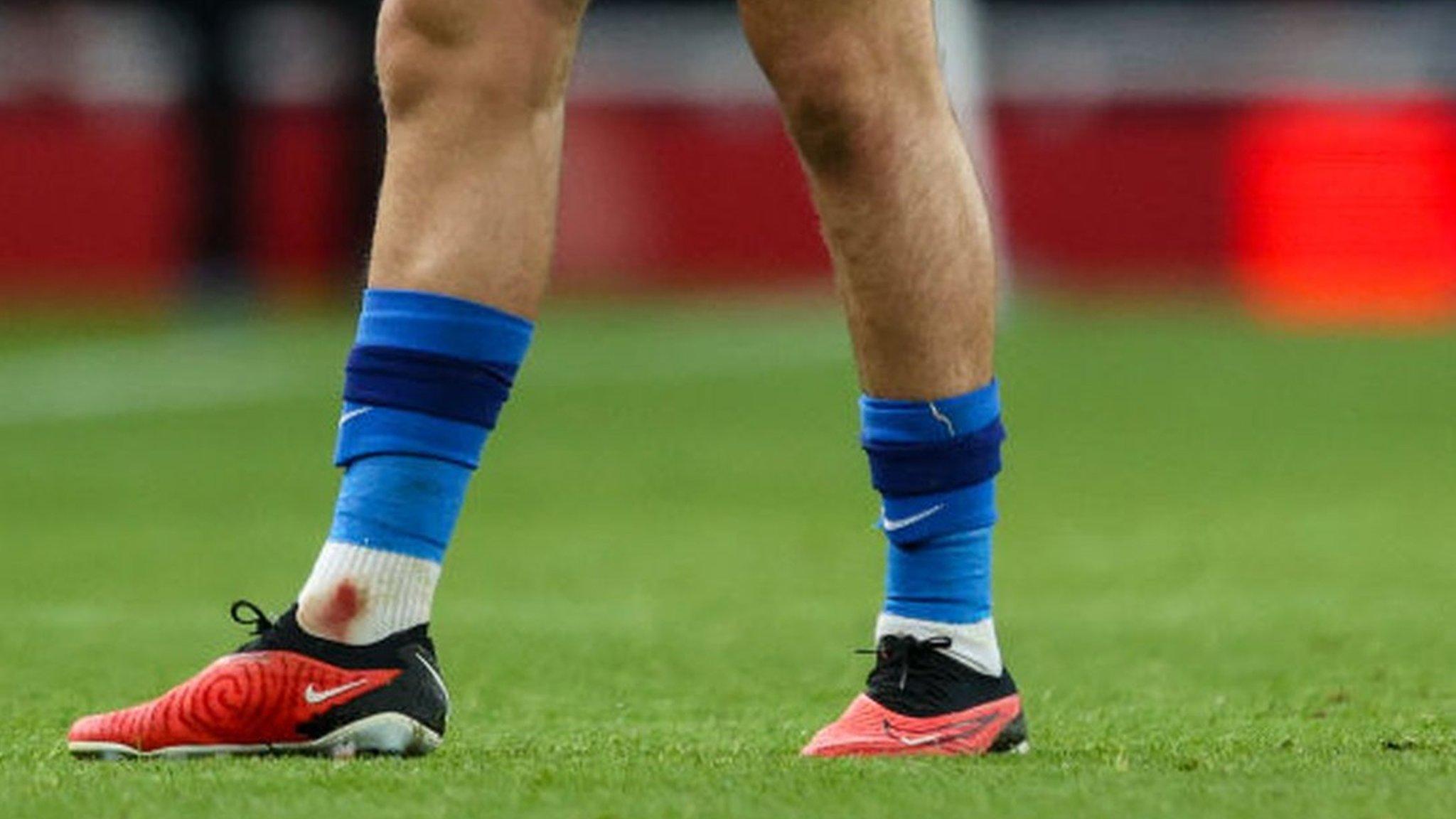 Brighton's Jack Hinshelwood wearing small shin pads