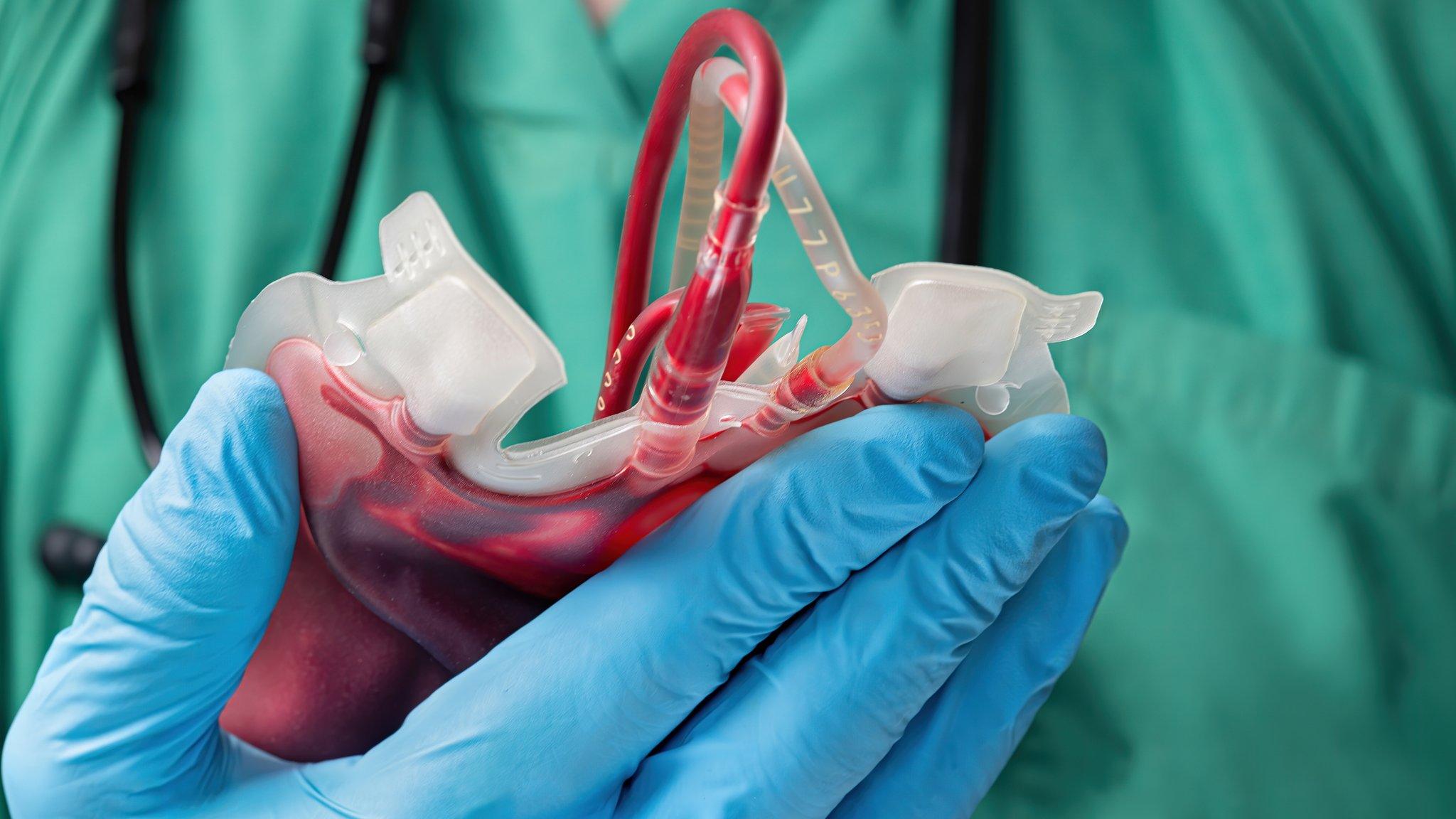 Medical staff member with surgical gloves on holding a blood bag