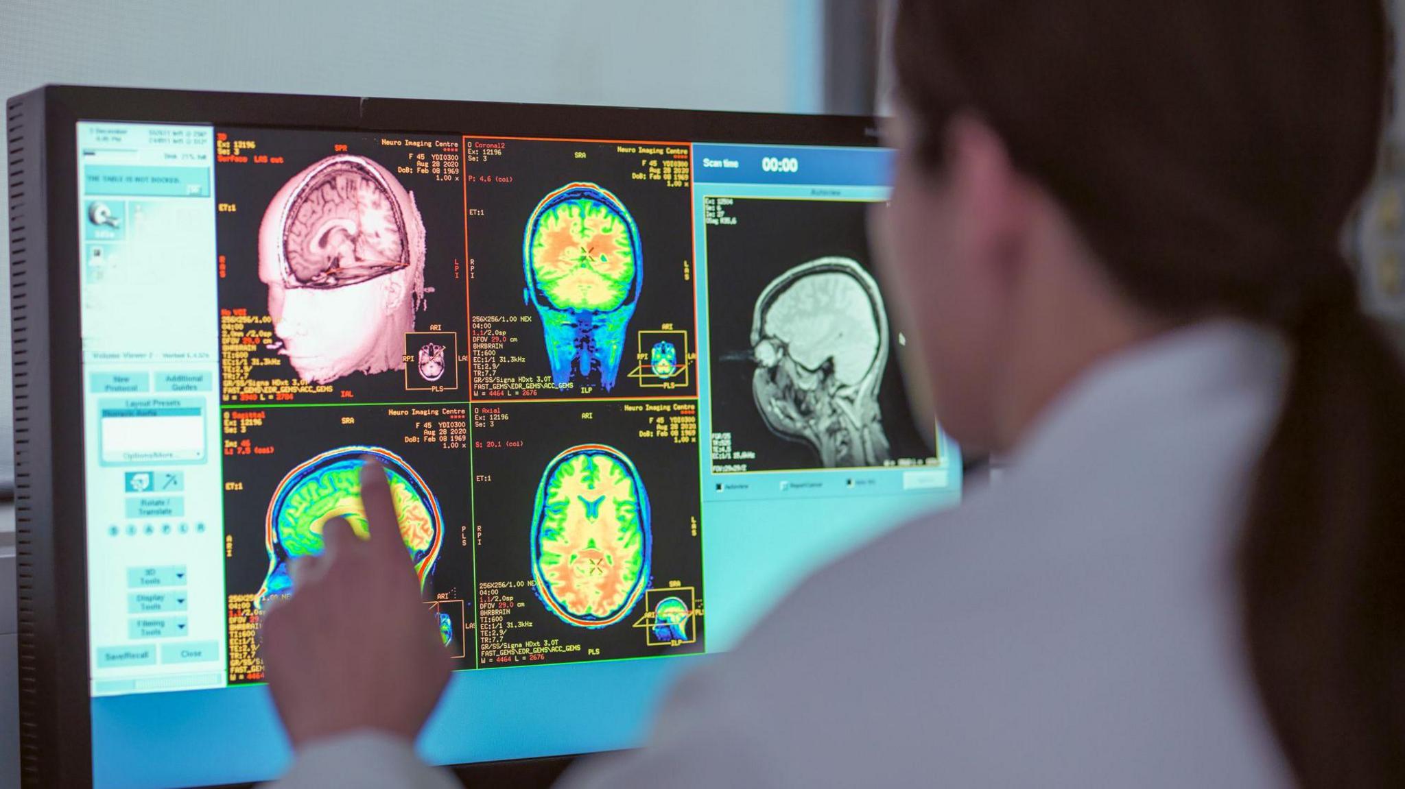A woman in a white coat uses her finger to touch a brain scan. 
