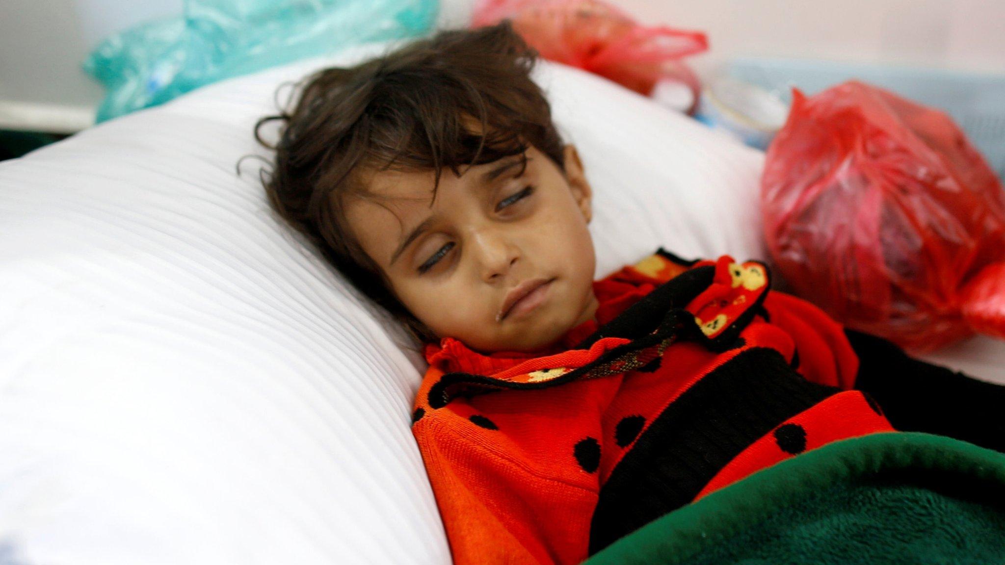 A girl infected with cholera lies on the ground at a hospital in Sanaa, Yemen (7 May 2017)