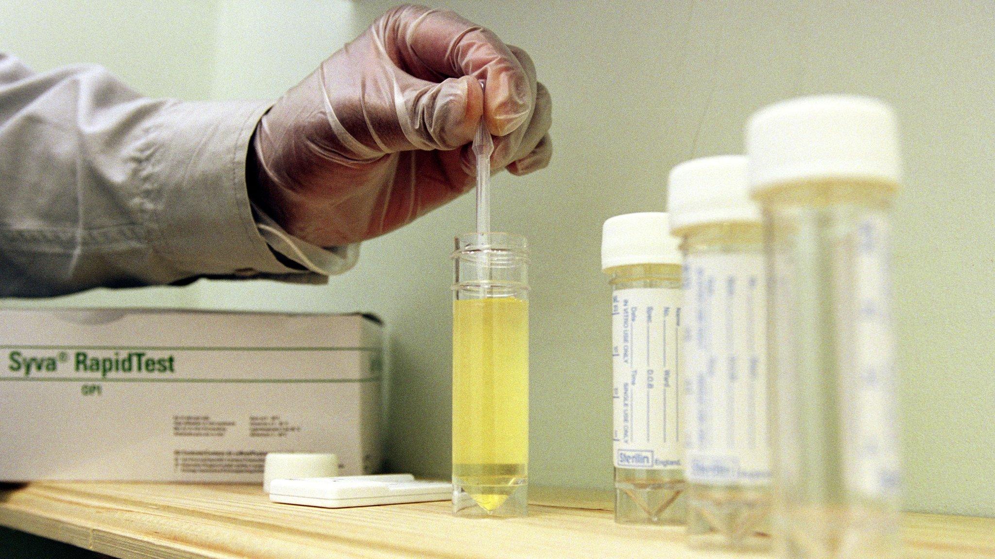 A urine sample is tested