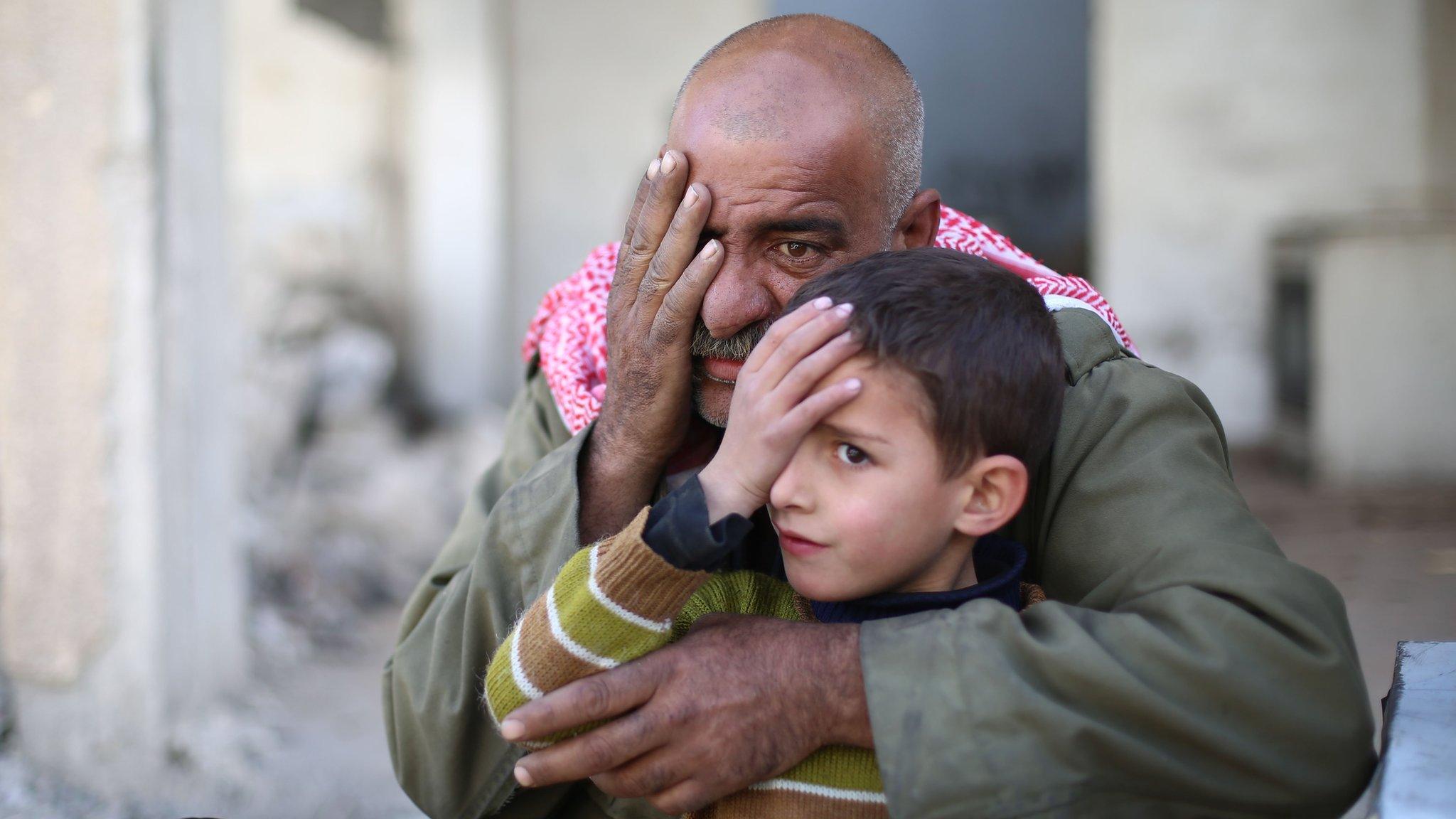 Syrians pose covering one eye with their hands in the rebel-held town of Douma in Syria's besieged eastern Ghouta region, on December 18, 2017, as part of a campaign in solidarity with a baby boy, Karim Abdallah, who lost an eye, as well as his mother, in government shelling on the nearby town of Hammouria