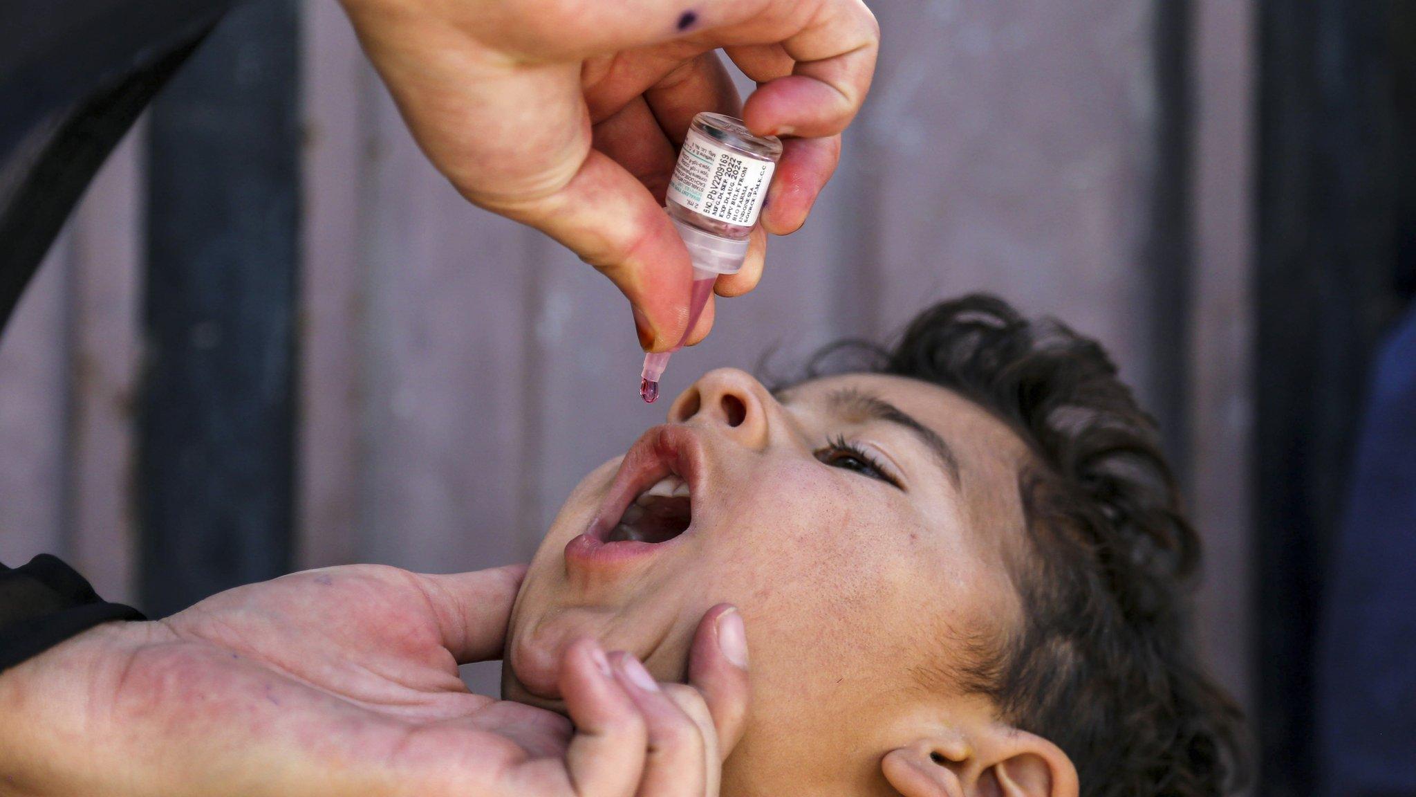 Polio vaccine