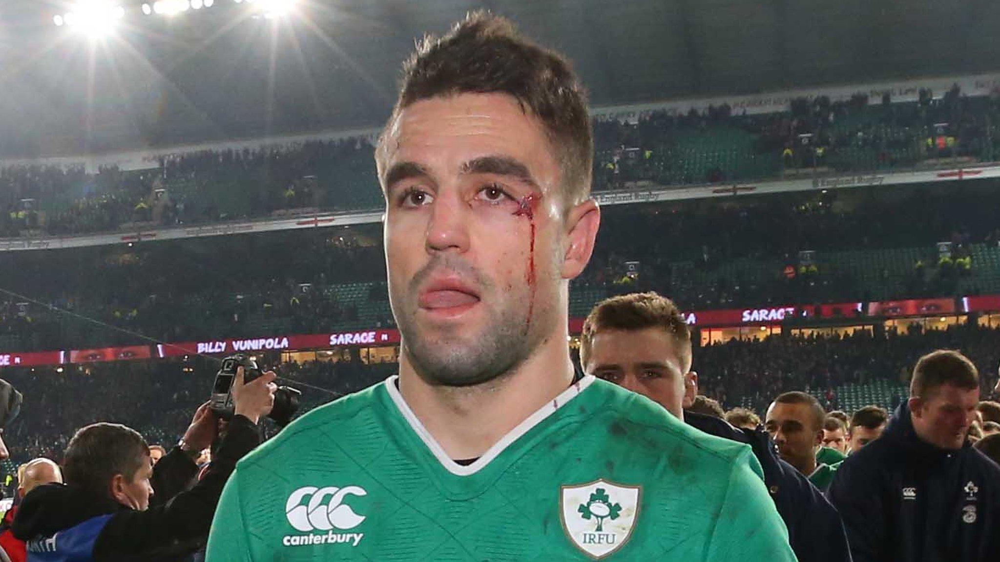 Conor Murray needed eight stitches around his eye after being caught by Mike Brown's boot