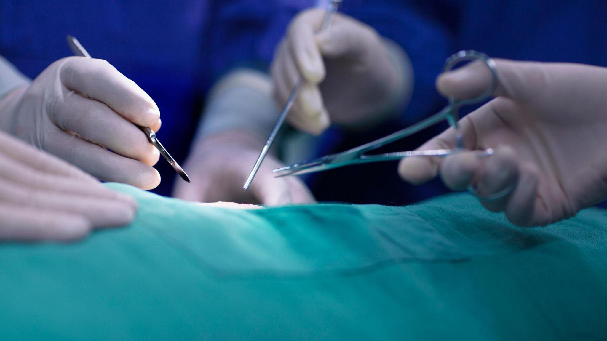 Close up photo of hands of operating room staff performing surgery. The instruments being held include a scalpel and forceps. There is a green medical sheet covering the patient.