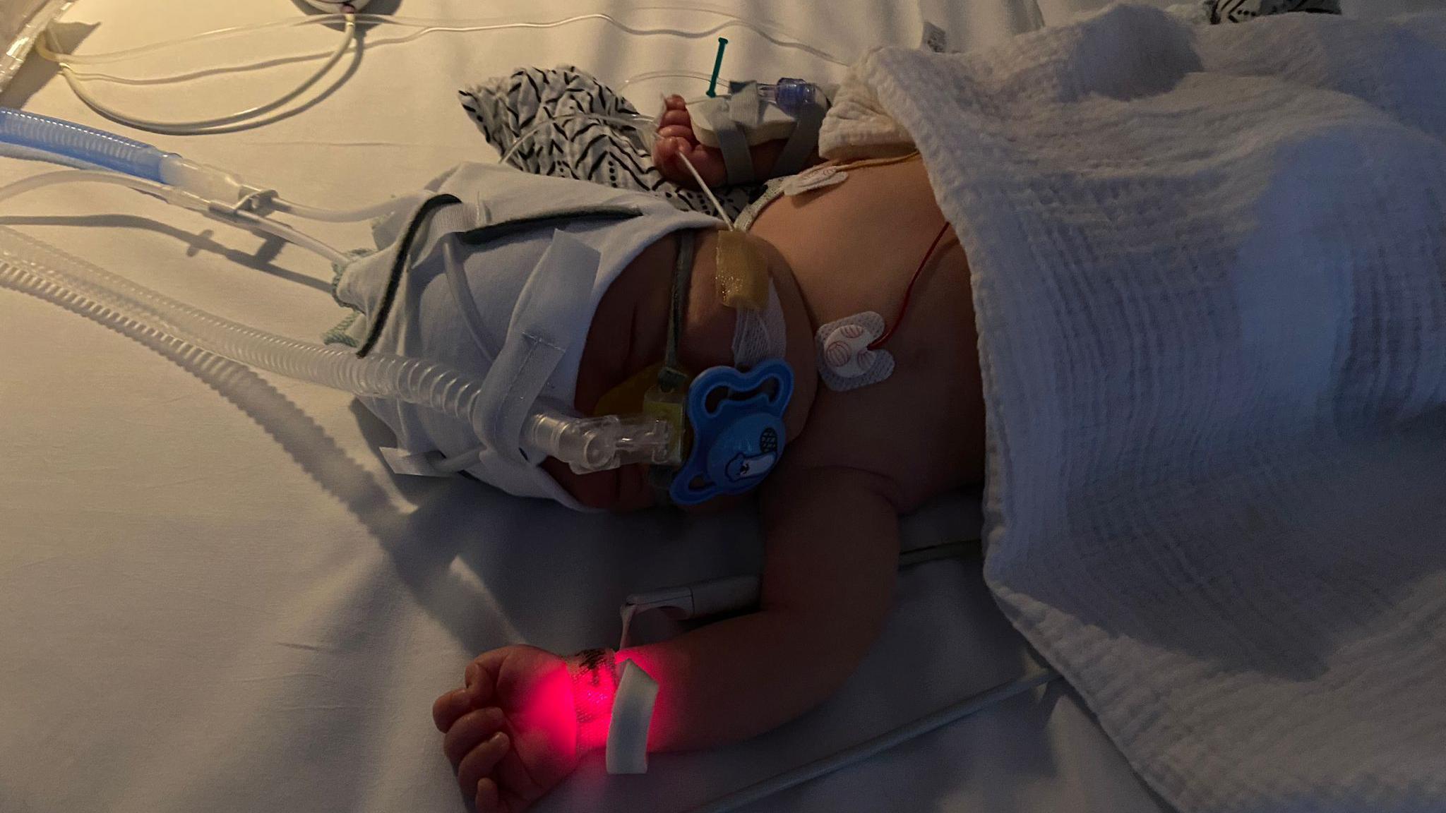 An image of a baby with a white blanket over him, he is connected to tubes lying in hospital.