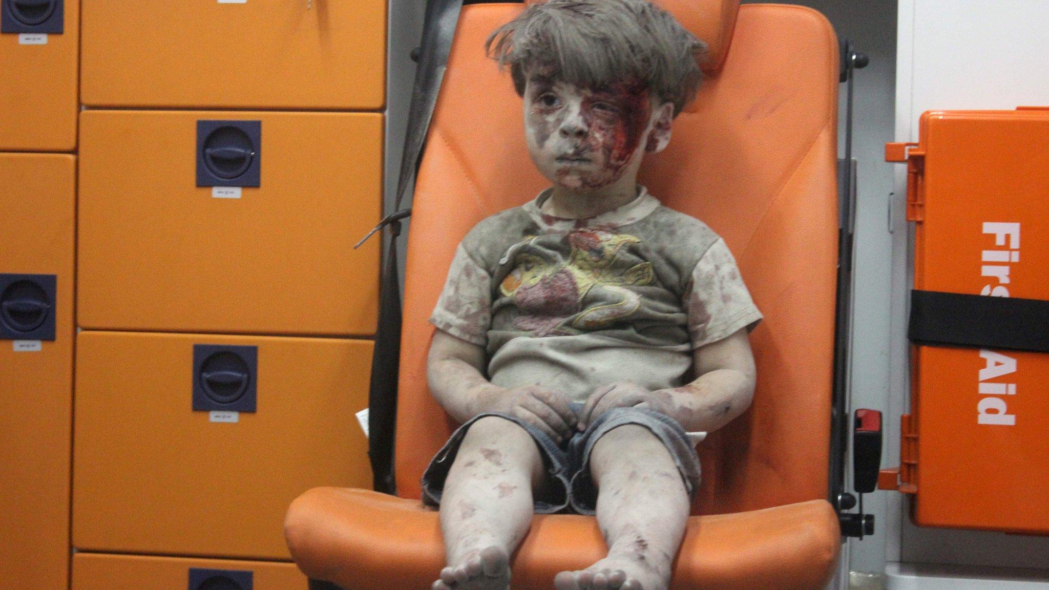 Photo showing Syrian boy Omran Daqneesh after his home was destroyed by an air strike in Qaterji, Aleppo, on 17 August 2016