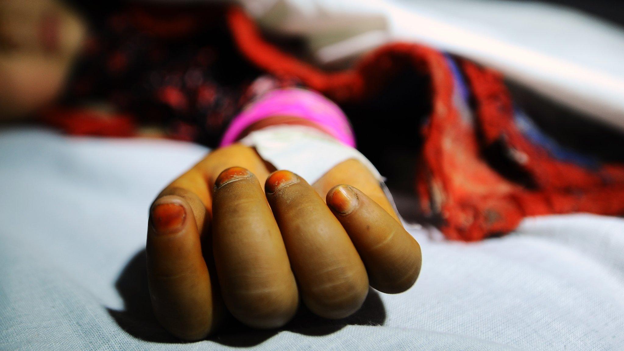 A girl, allegedly raped by a man, lies in a hospital bed