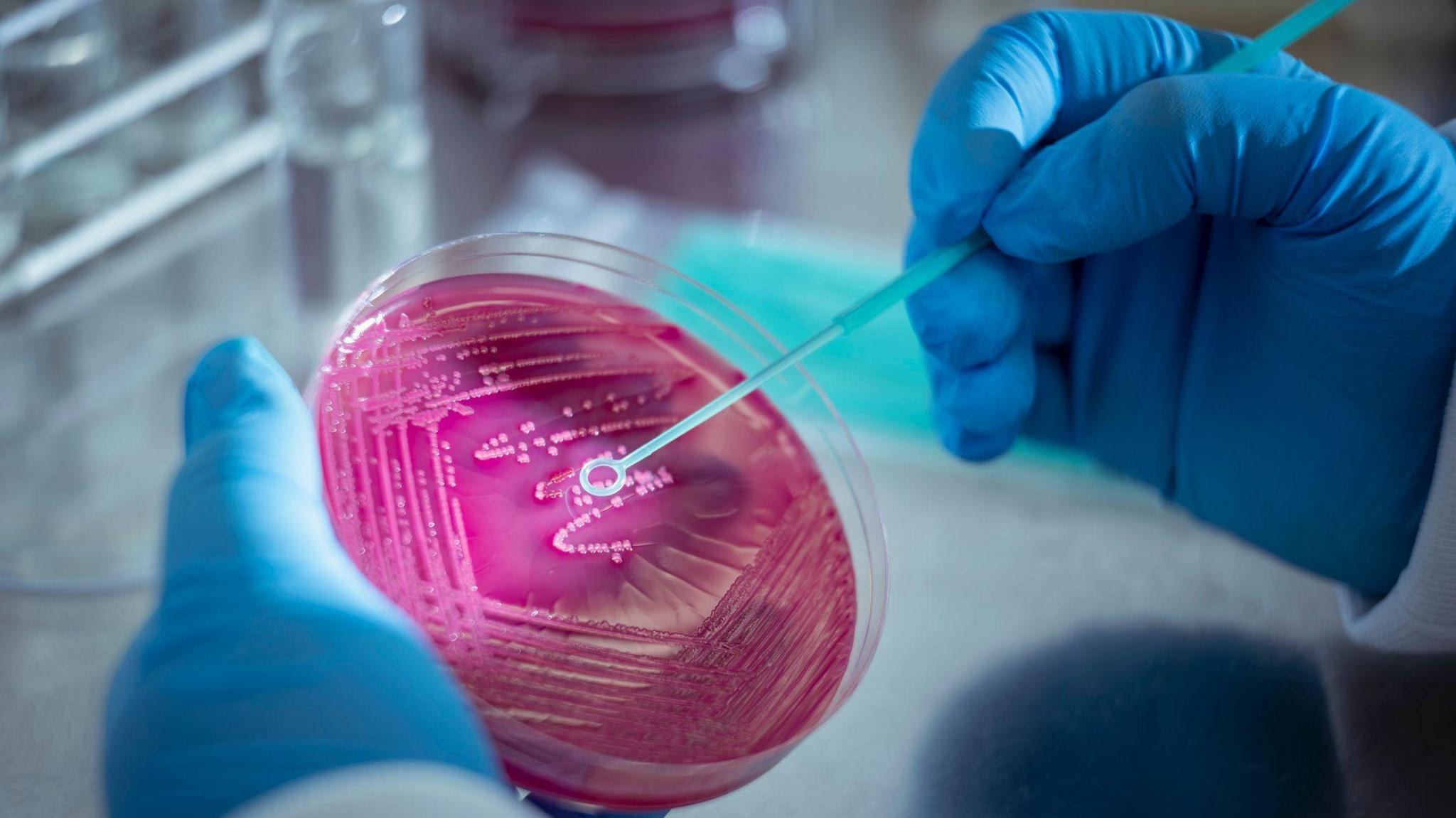 A petri dish filled with pink bacteria is being swabbed by a blue stick in a laboratory. The scientist is wearing blue gloves and a white lab coat.