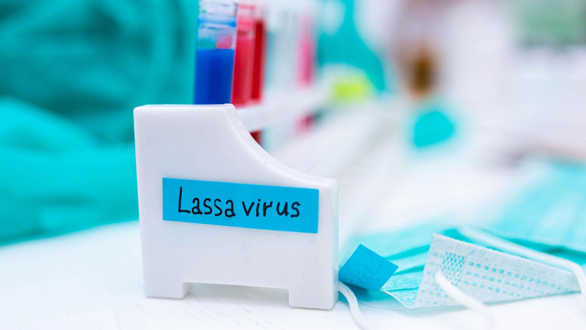 Lab samples being tested for Lassa virus