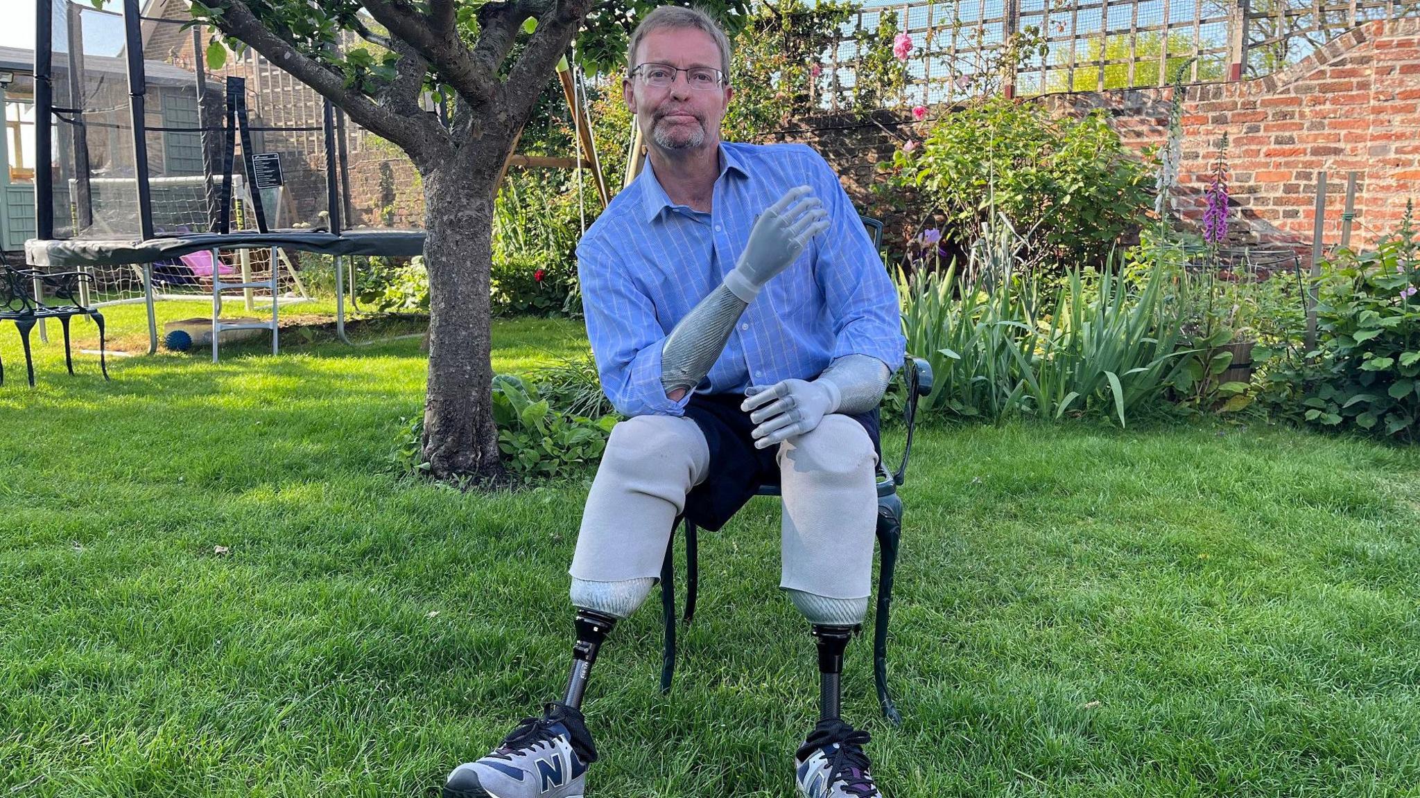 Lord Mackinlay is sitting on a chair that is on the lawn of a garden. He has on prosthetic arms and legs and is wearing a blue shirt and black shorts. There are flowers and a trampoline behind him. 