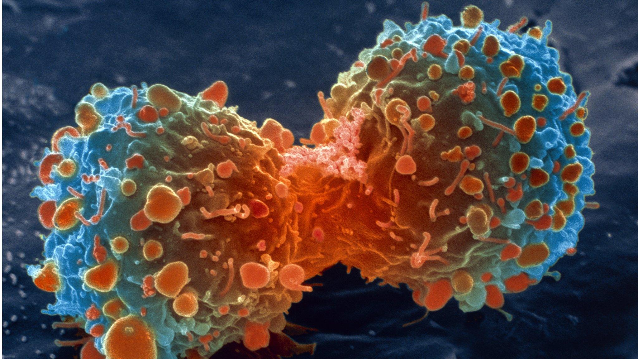 Cancer
