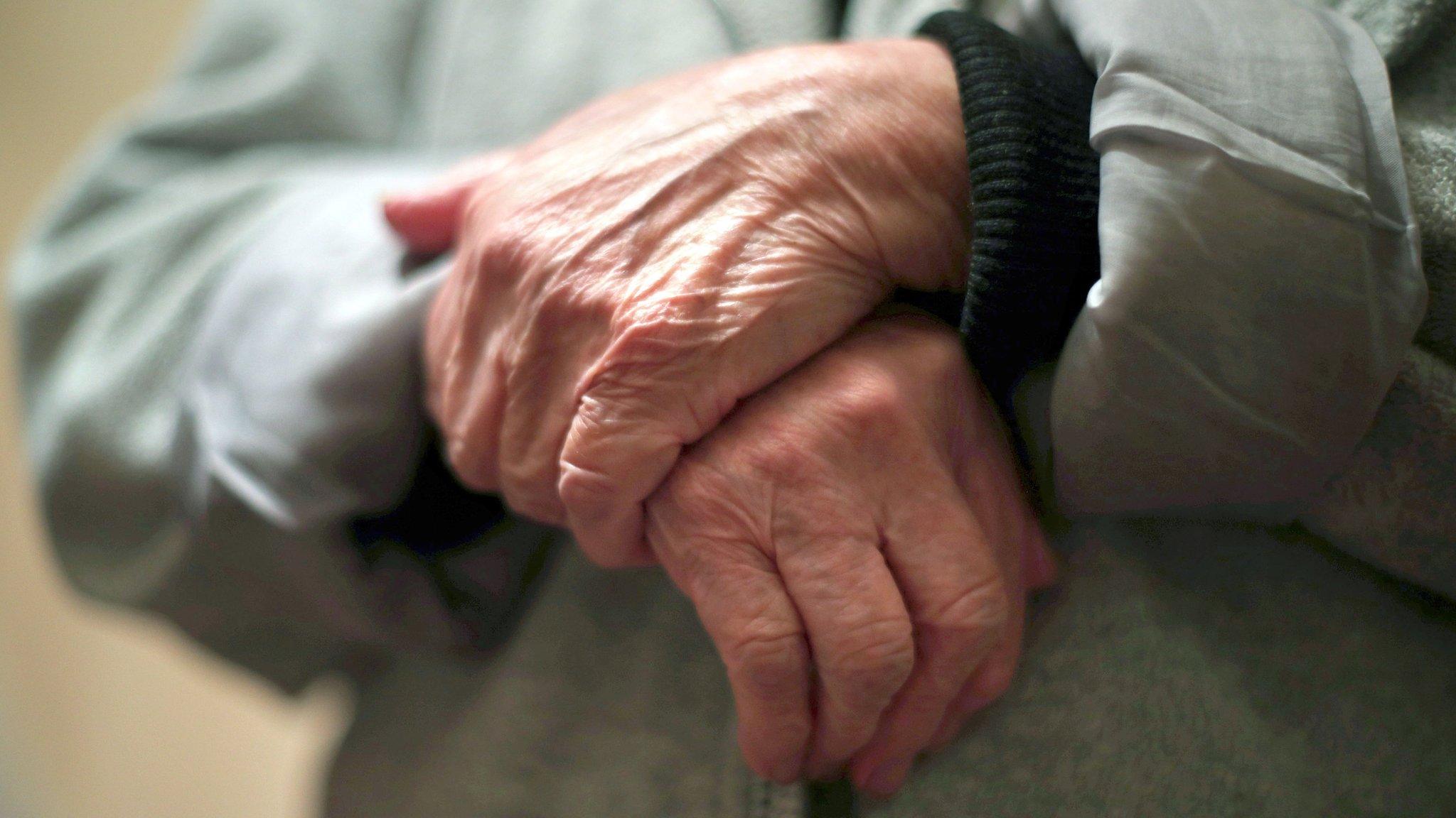 Folded arms of an elderly person