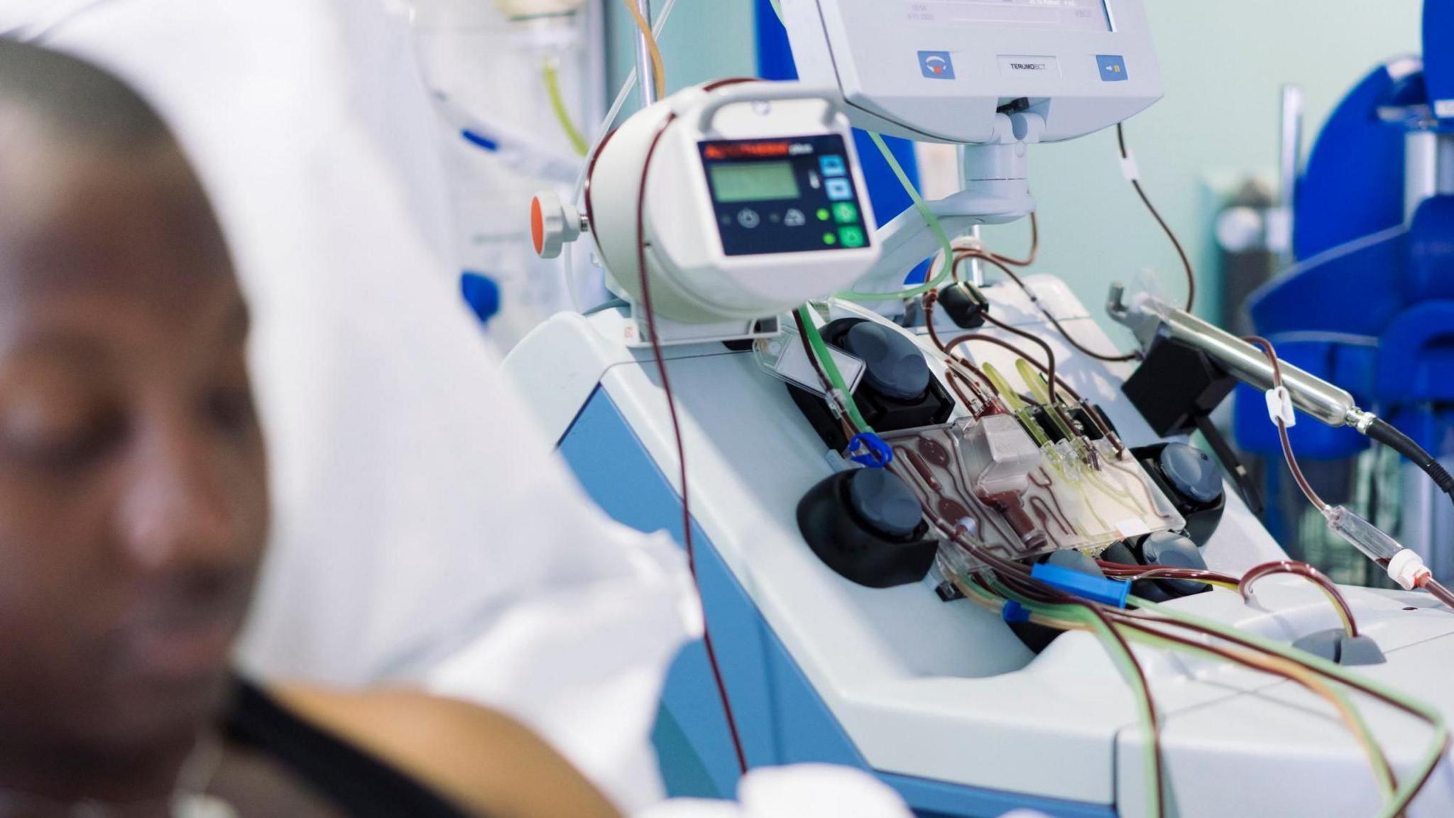 Several tubes with blood inside lead out of a red cell exchange blood donation machine.