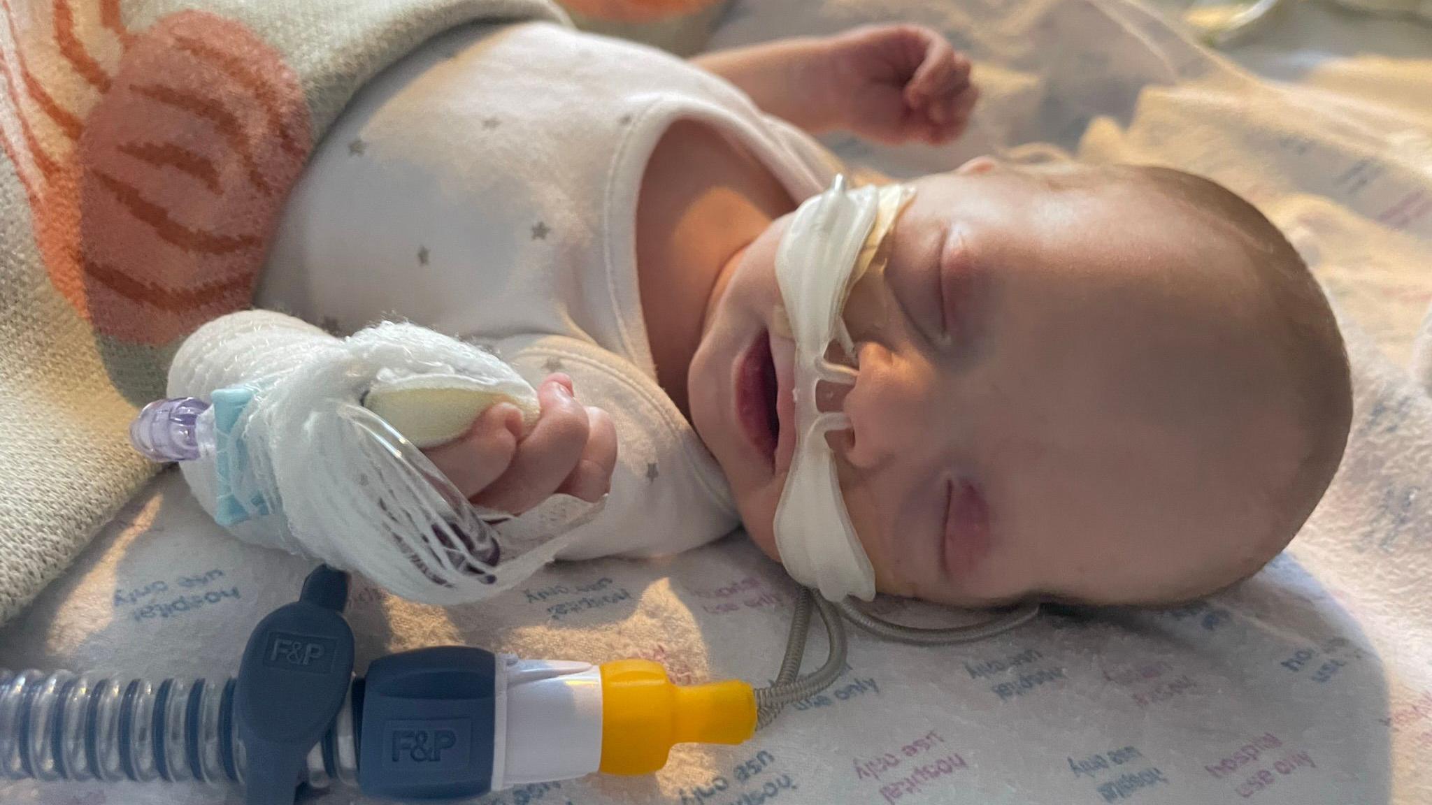 A three week old baby lying on a blanket in hospital with medical tubes up her nose. She has her eyes closed and her arms up by her side 