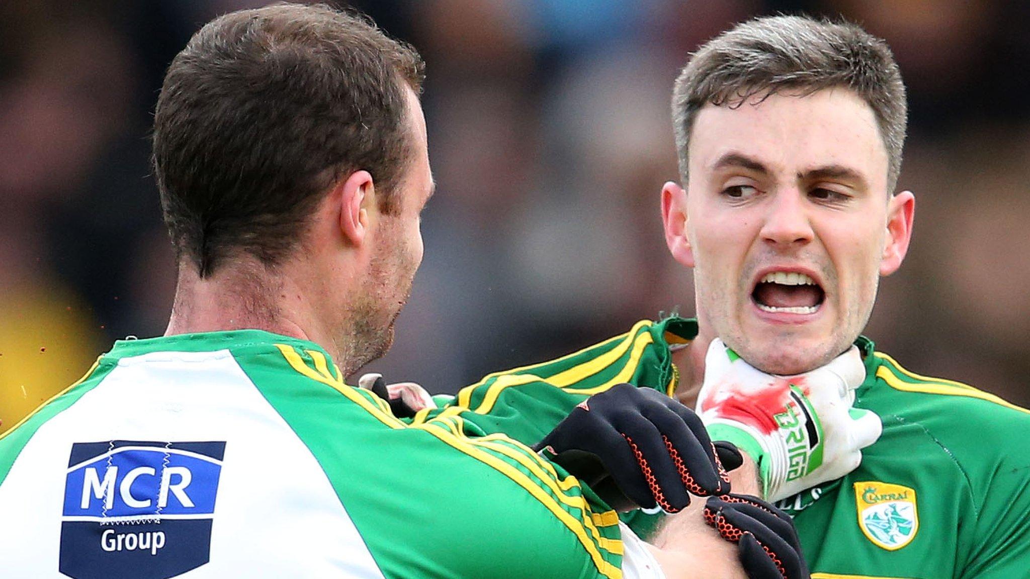 Kerry's Alan Fitzgerald was sent off early on at Tralee after tangling with Donegal's Neil McGee