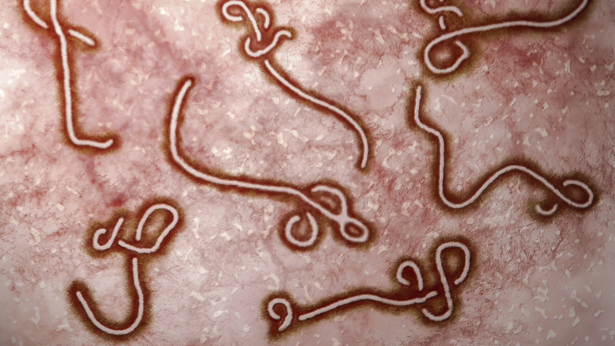 Ebola virus