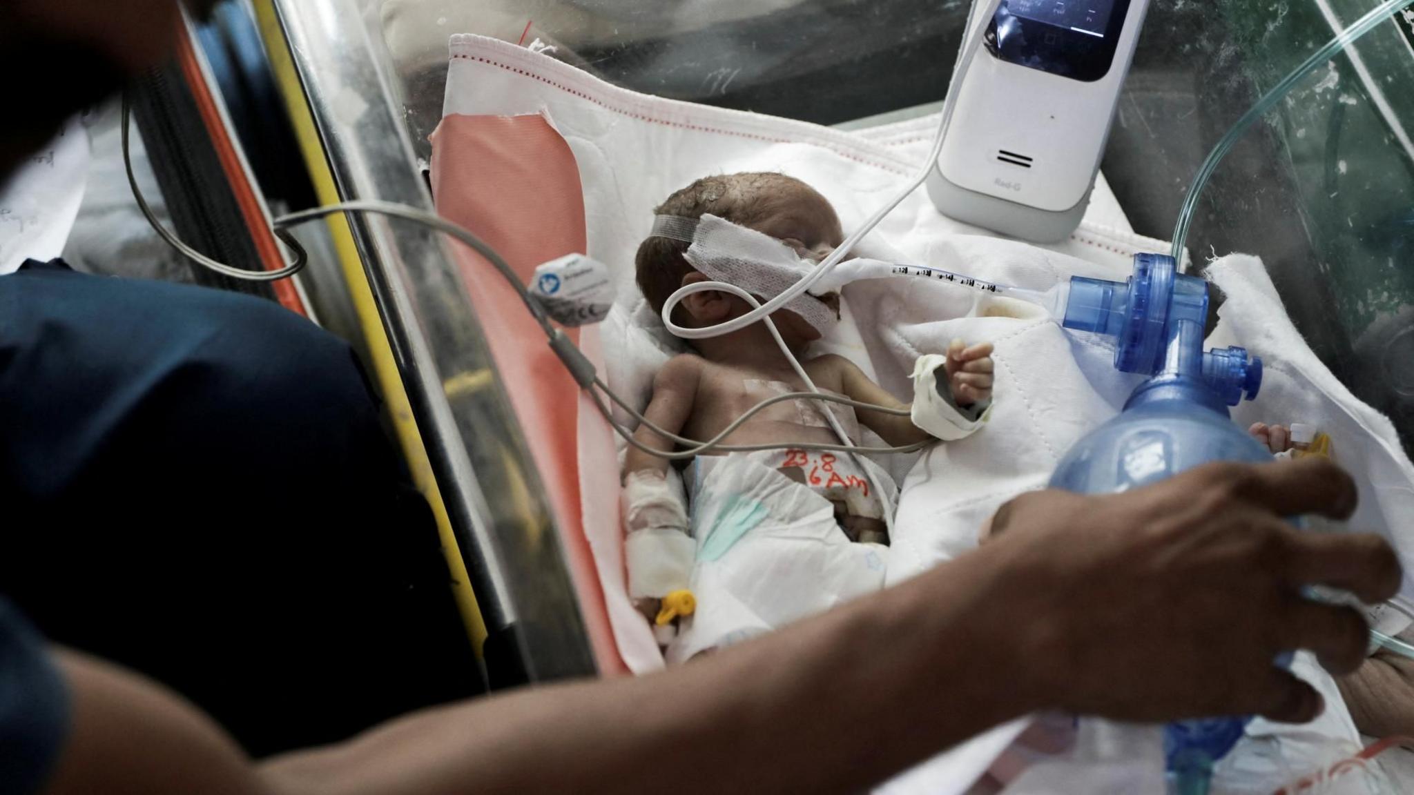 A Palestinian premature baby is evacuated from al-Aqsa hospital in Deir al-Balah to Nasser hospital in Khan Younis on 26 August 2024