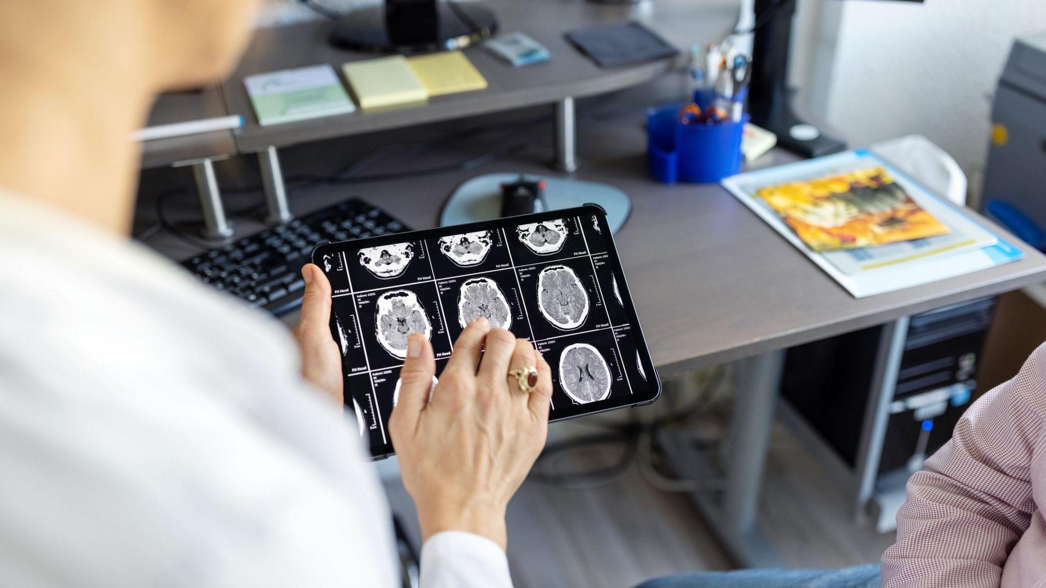 A women in a white doctors coat showing brain scans to someone off screen