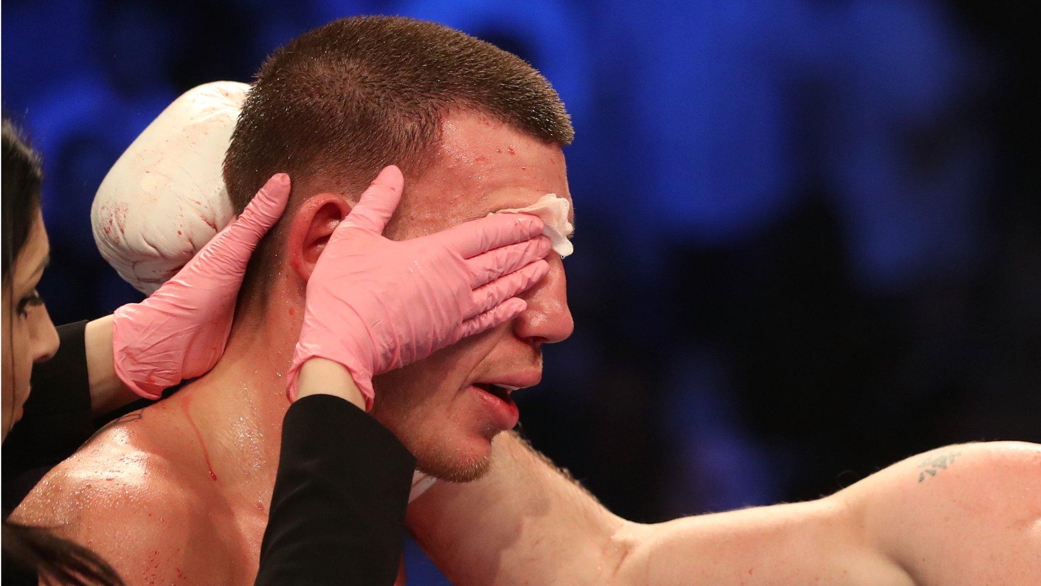 Liam Williams's eye is covered after the bout ends