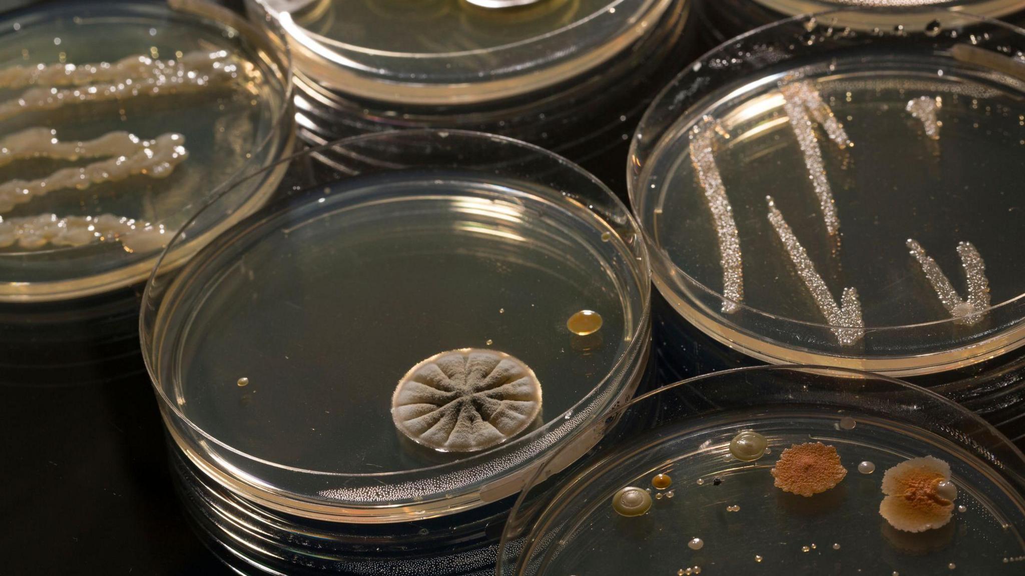 Petri dishes with bacteria cultures