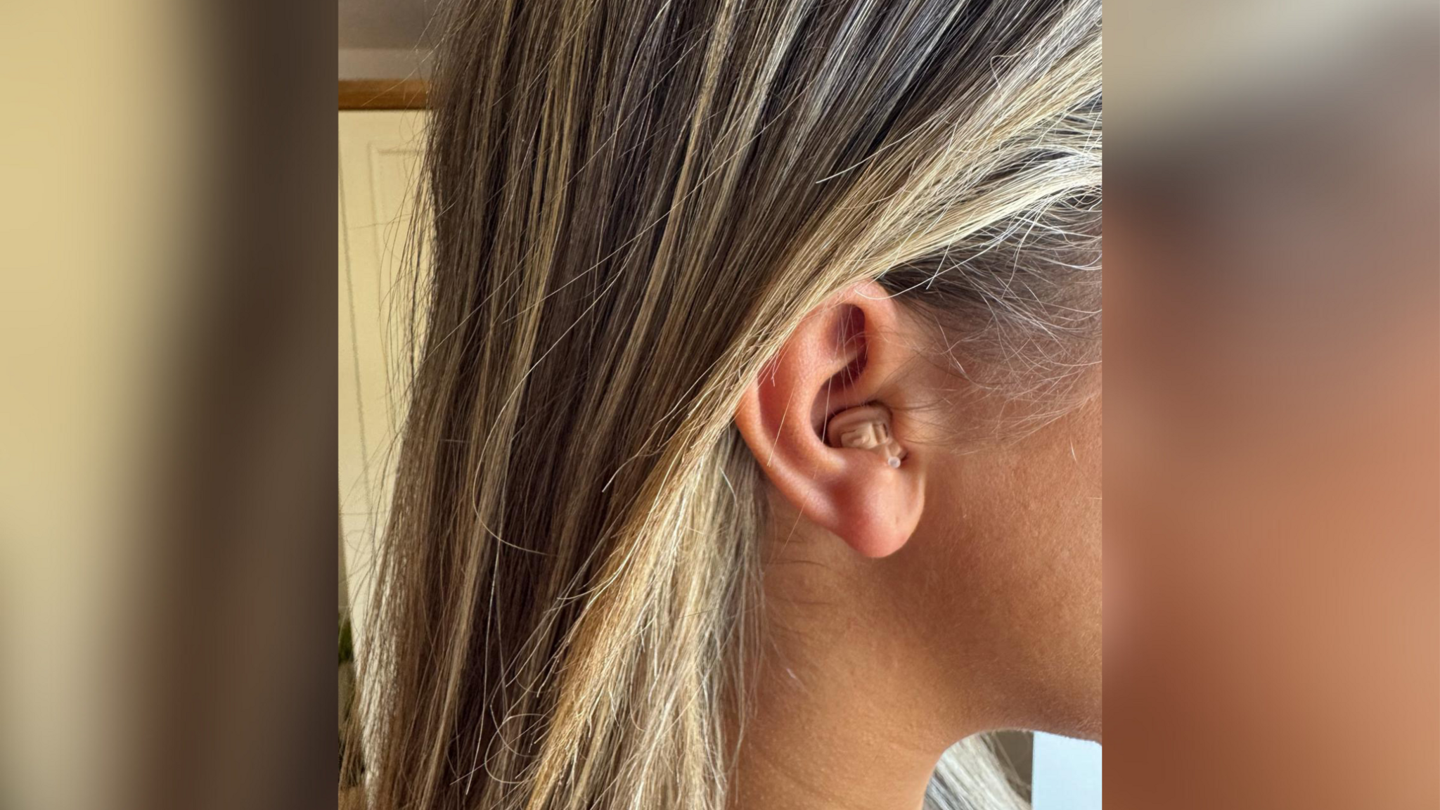 Ella's hearing aid, which is the same colour as her skin and fits inside her ear.
