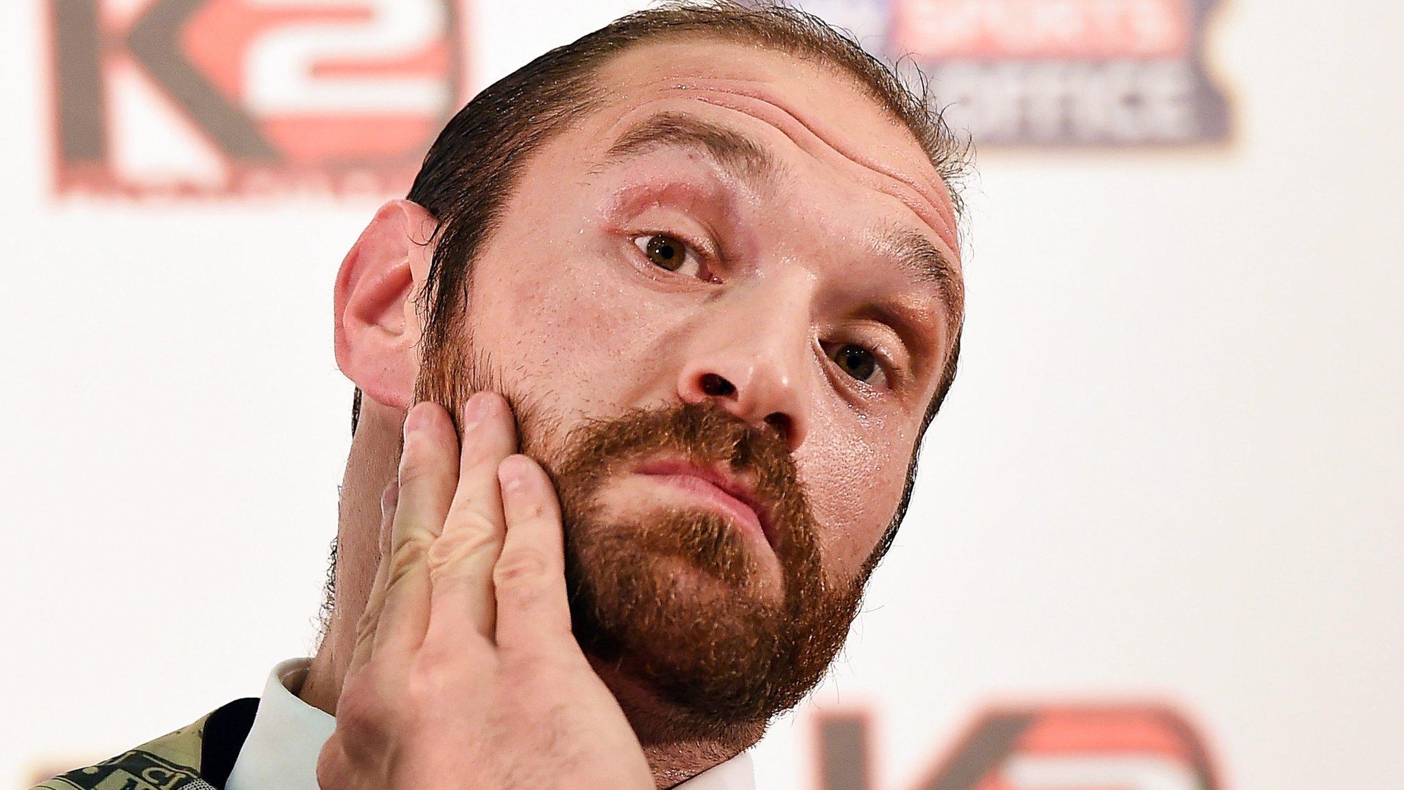 Tyson Fury