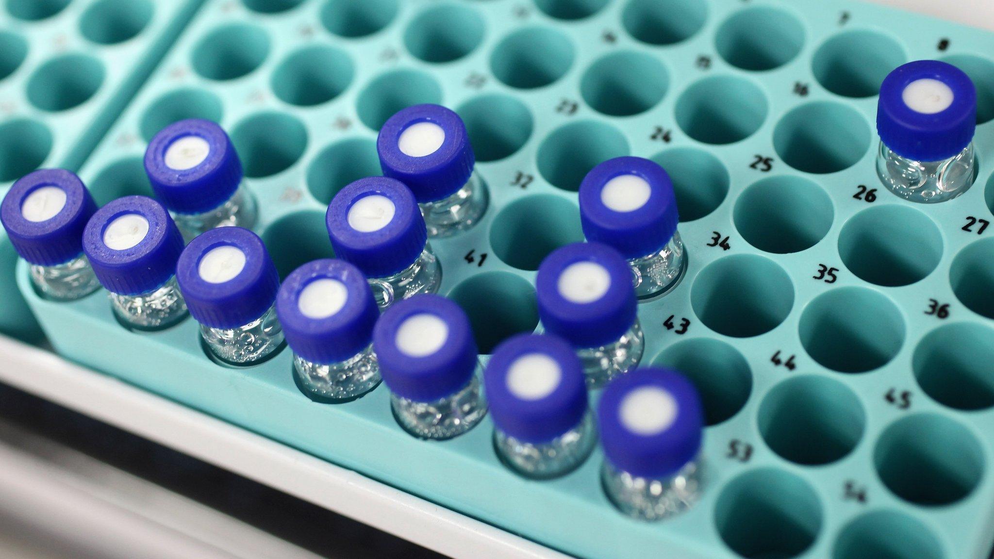 Samples in an anti-doping laboratory