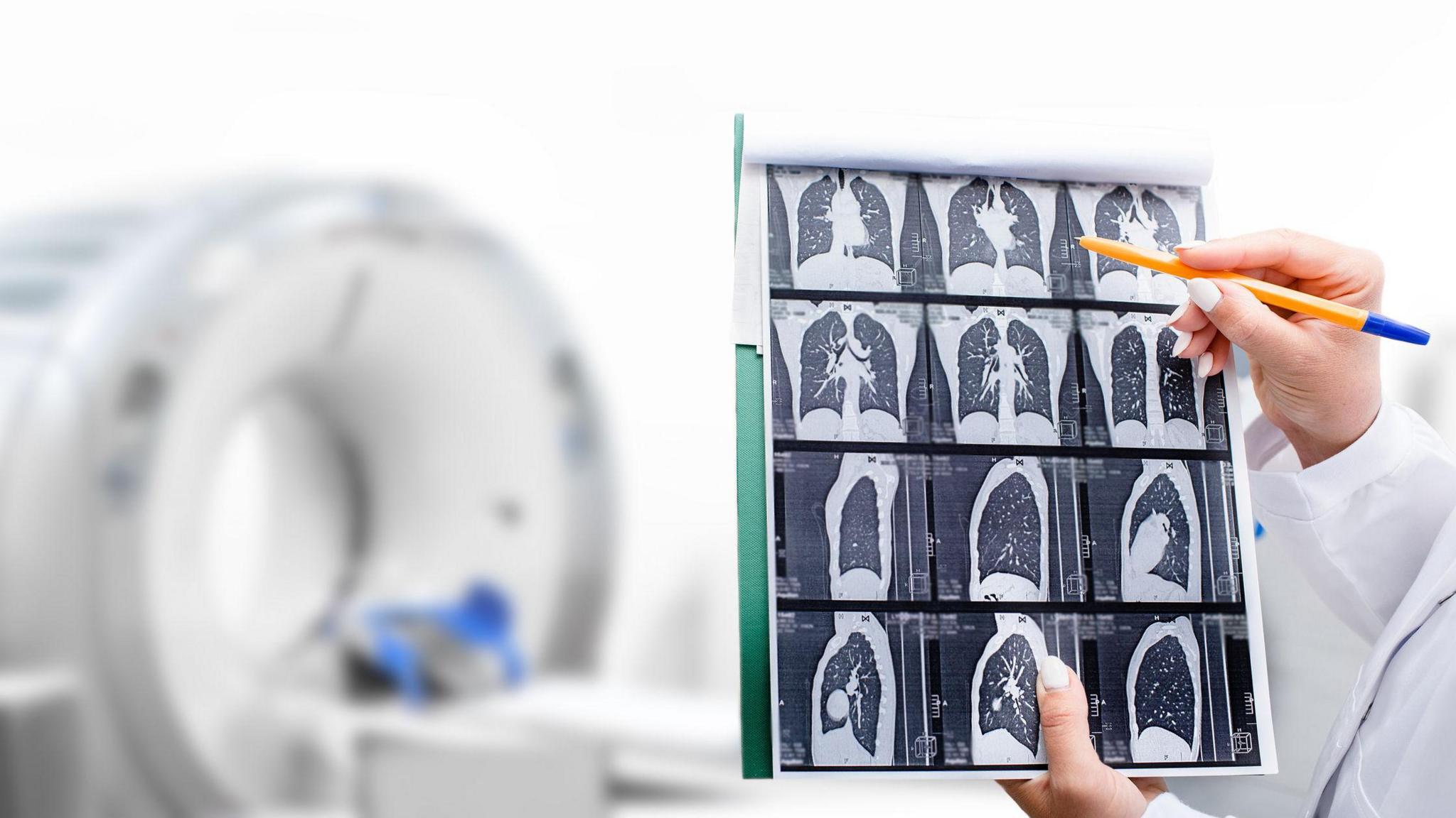 Scans of lung in black and white with a white CT scanner machine out of focus in the background with the arm of a medic in a white coat pointing at the scans with a ballpoint pen