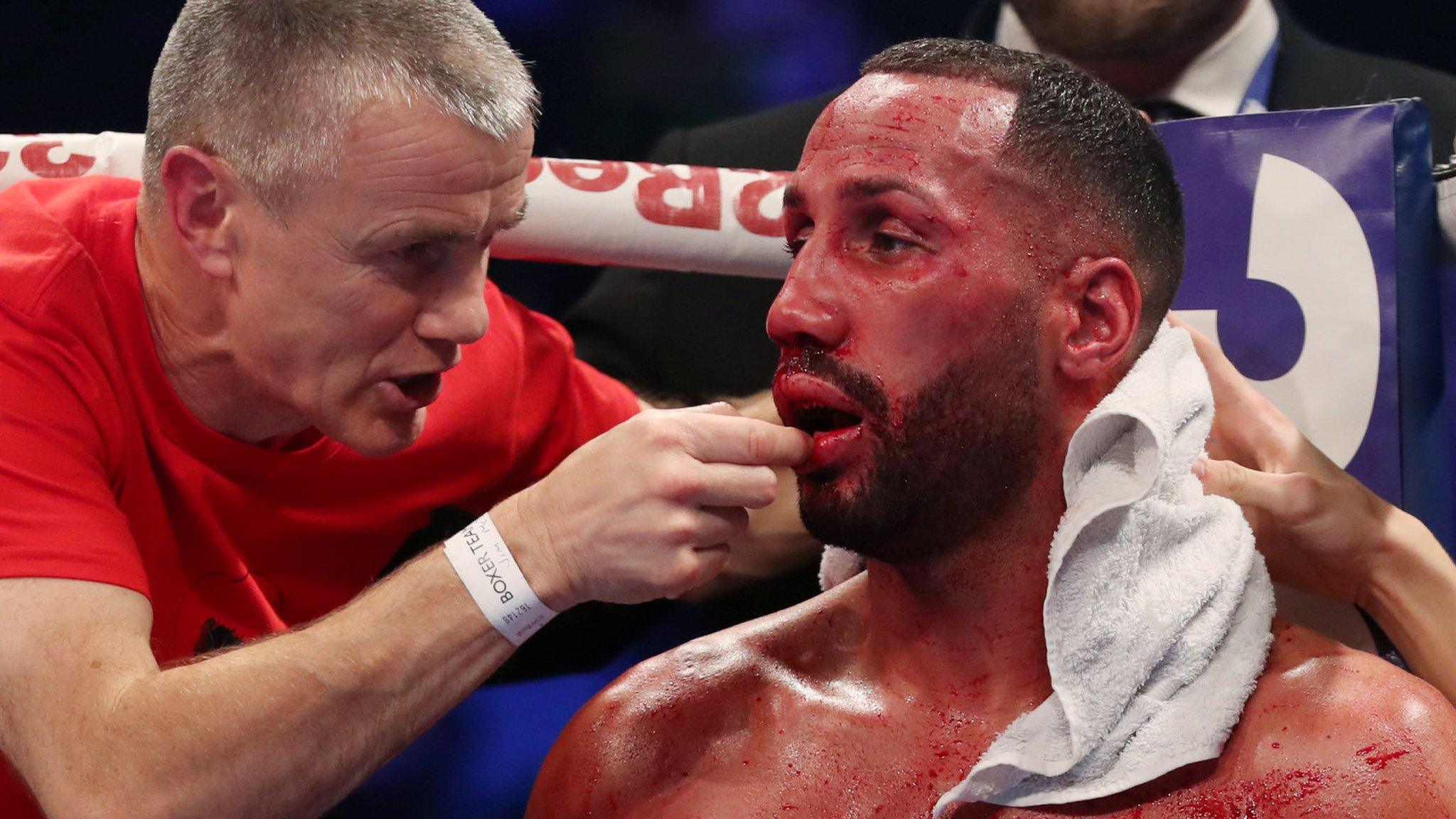 DeGale