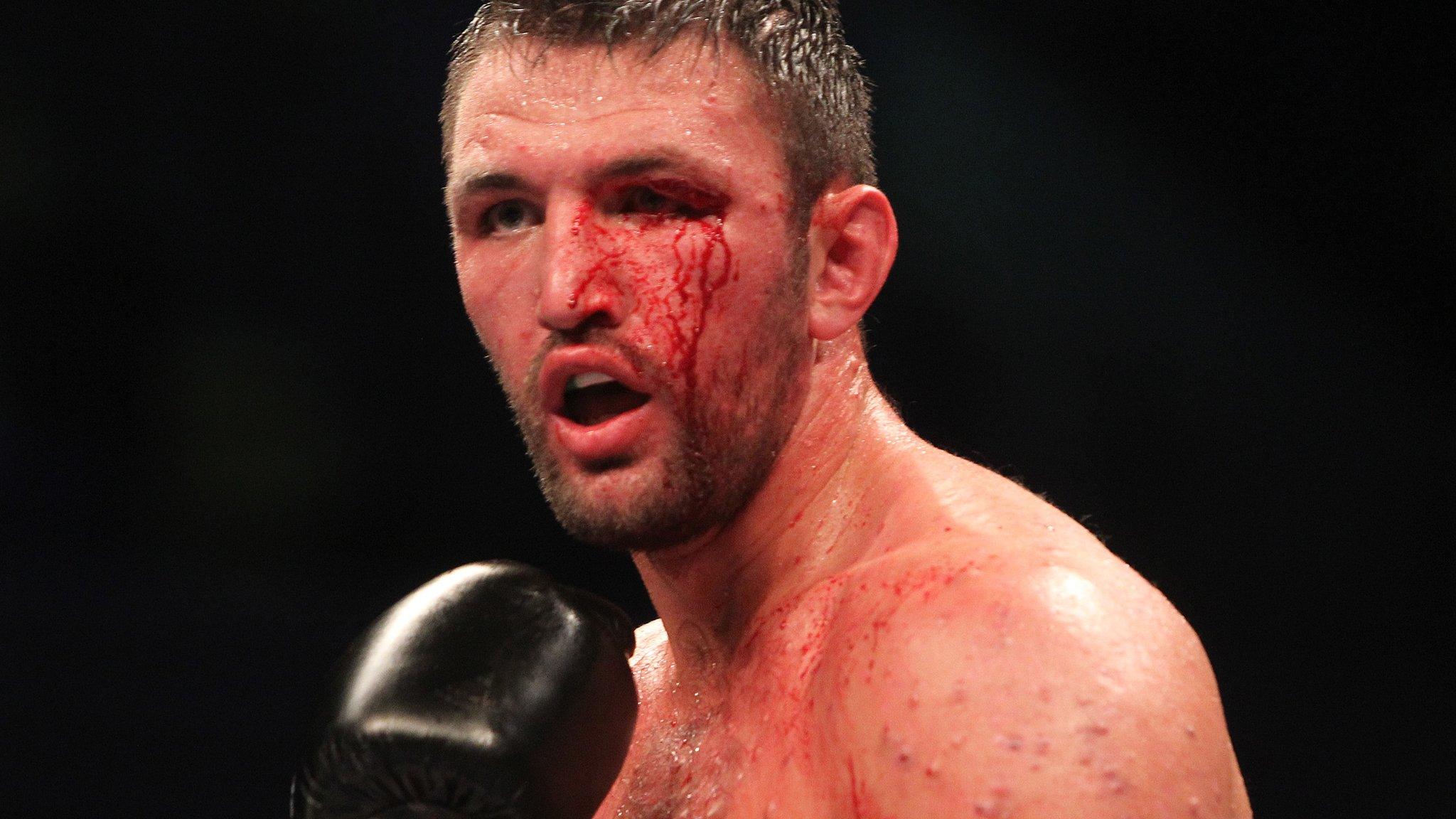 Hughie Fury