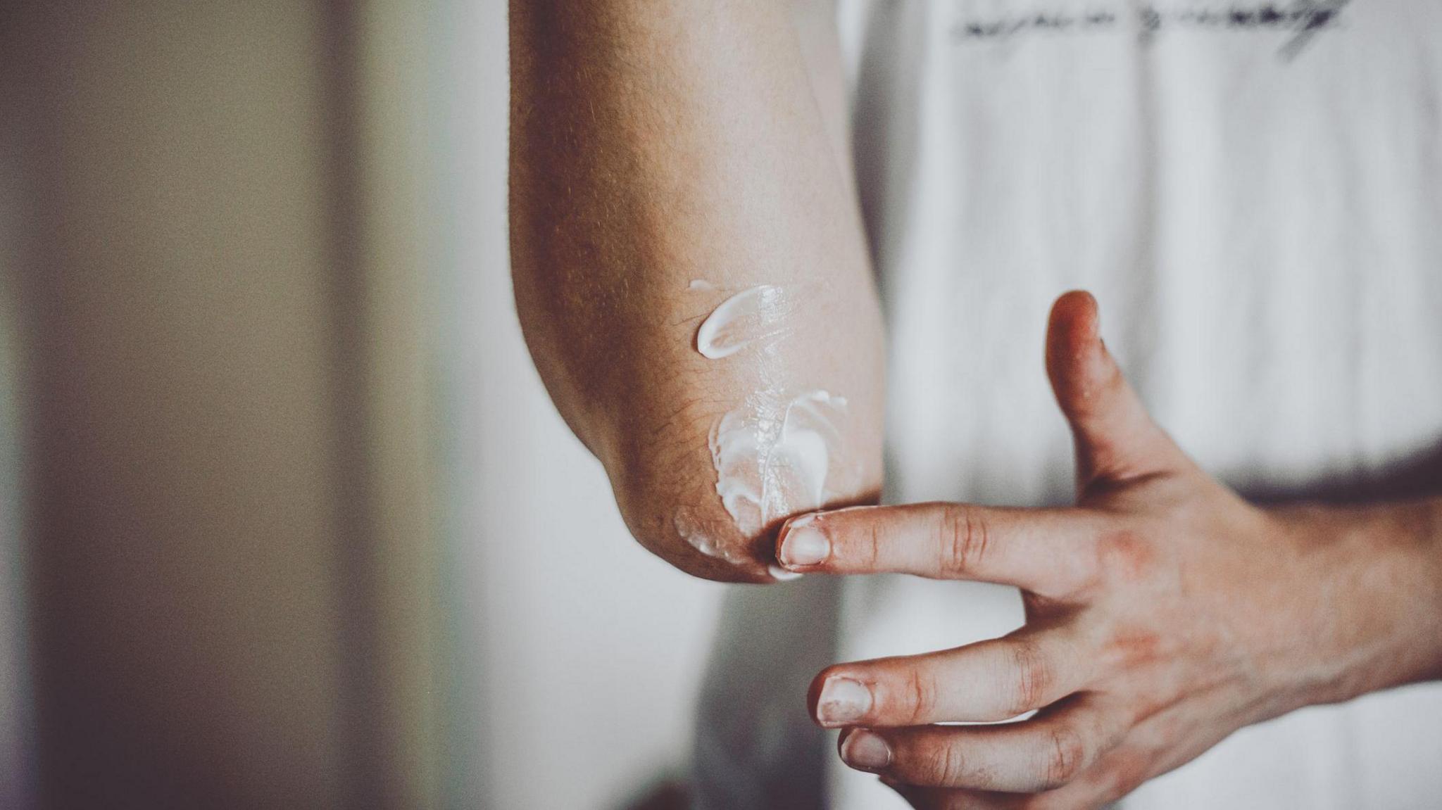 A person applies cream to their elbow