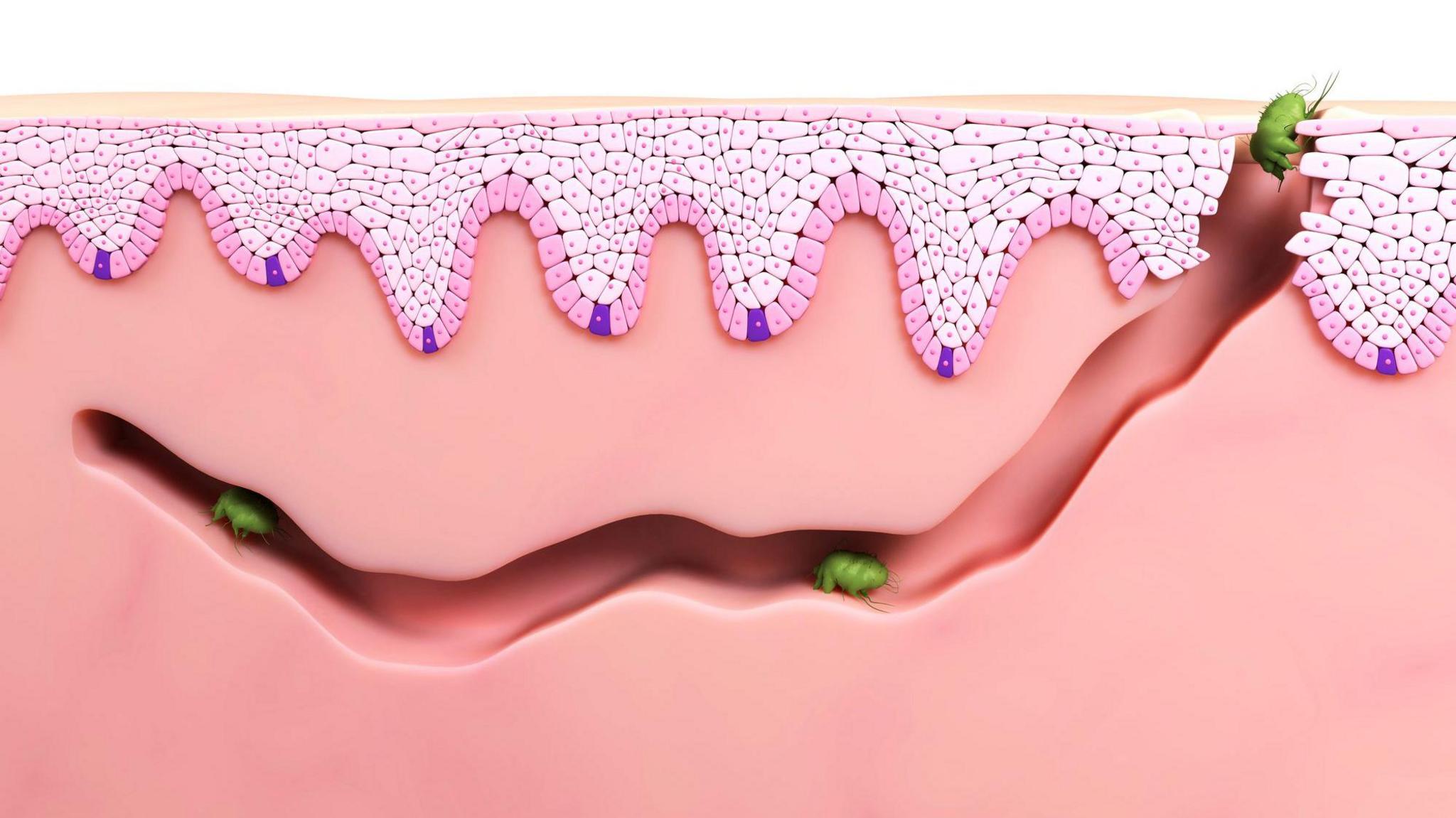 Një imazh i gjeneruar nga kompjuteri tregon se si marimangat e zgjebës depërtojnë në lëkurën e njeriut