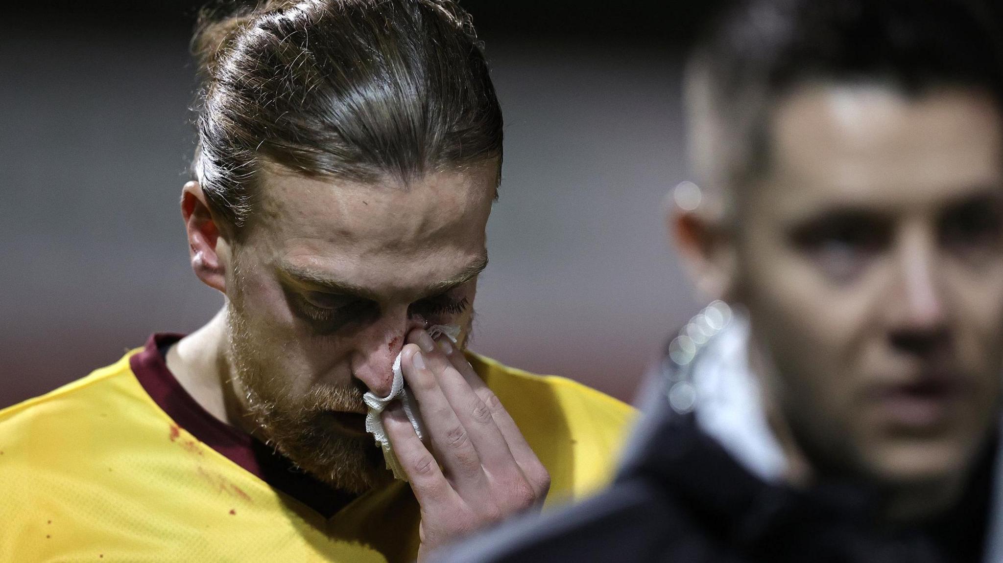 Northampton striker Tom Eaves leaves the field against Lincoln on 29 October after a bang in the face